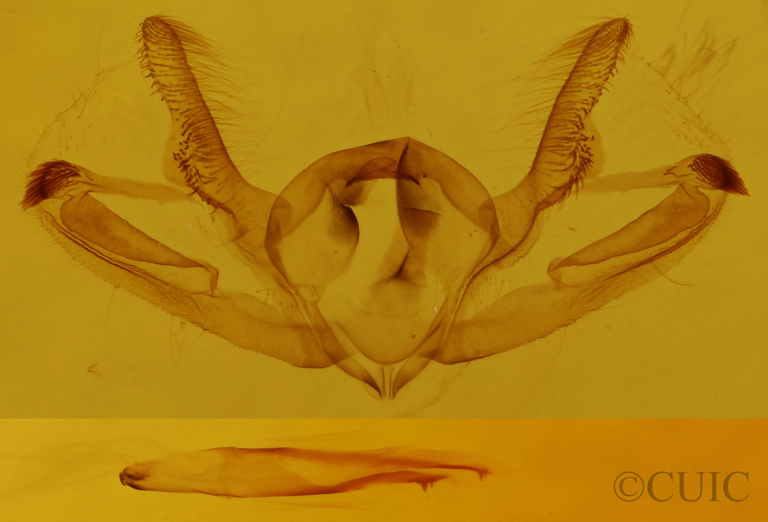 genitalia view of adult Aethalura intertexta