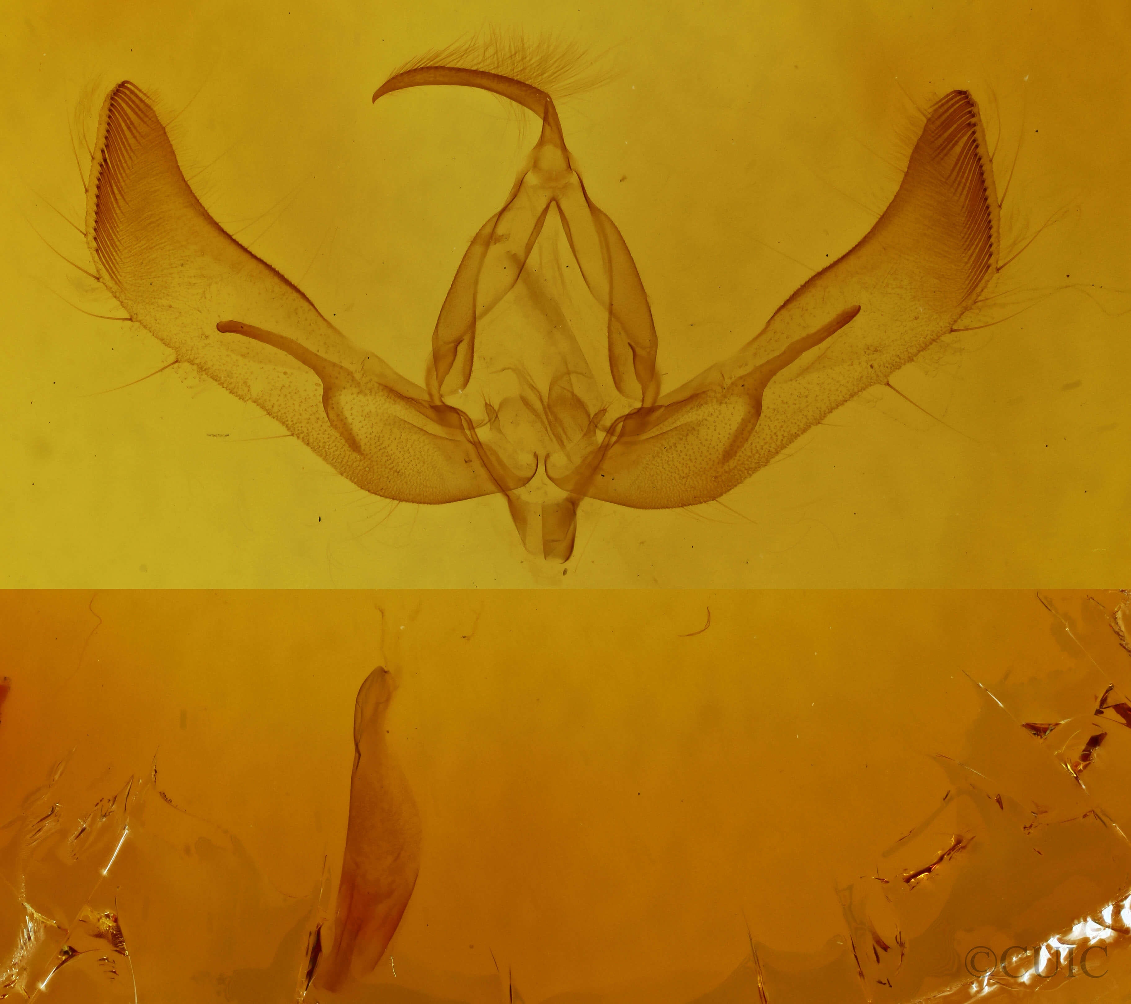 genitalia view of adult Feltia subterranea