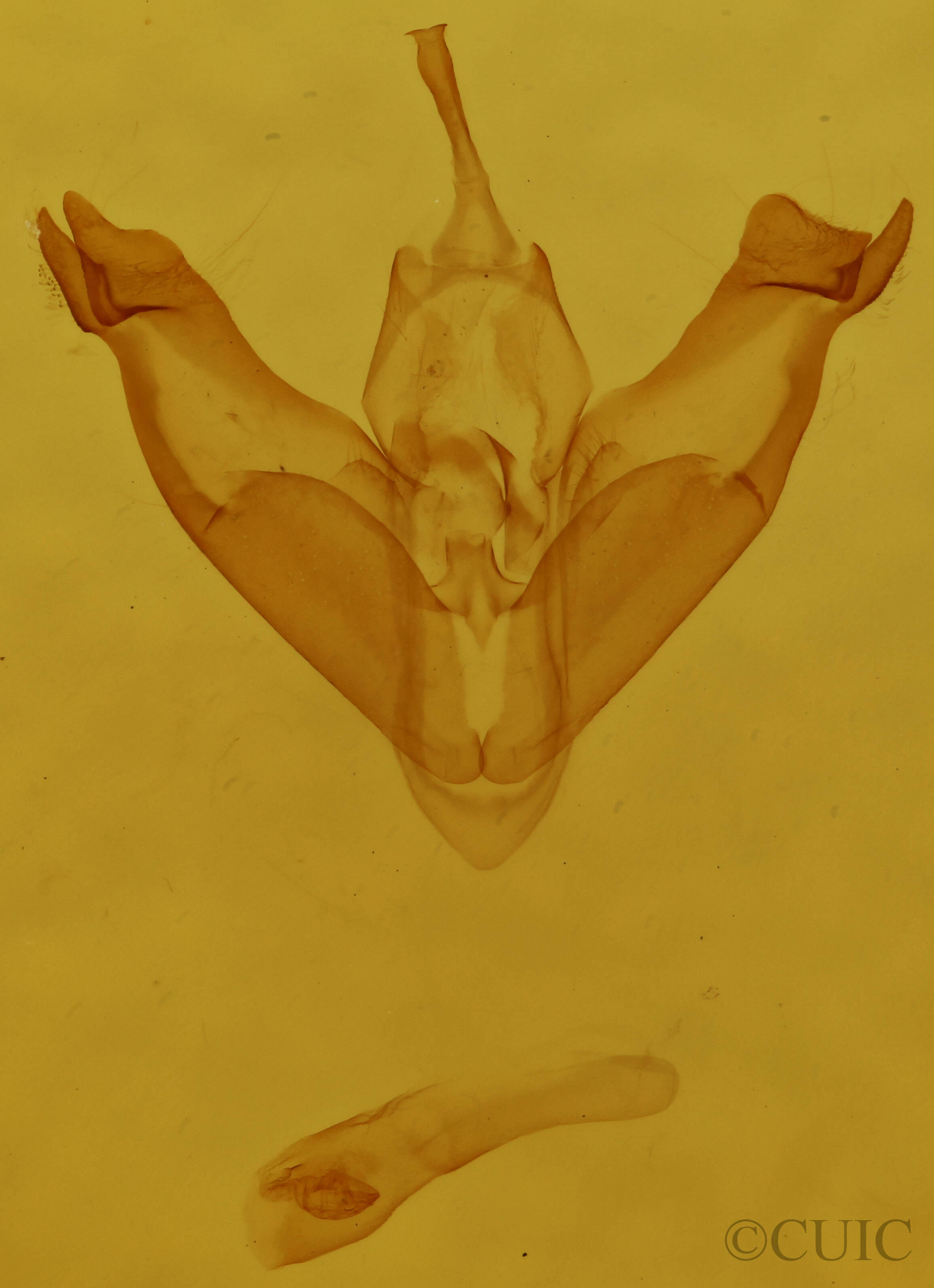 genitalia view of adult Amolita fessa