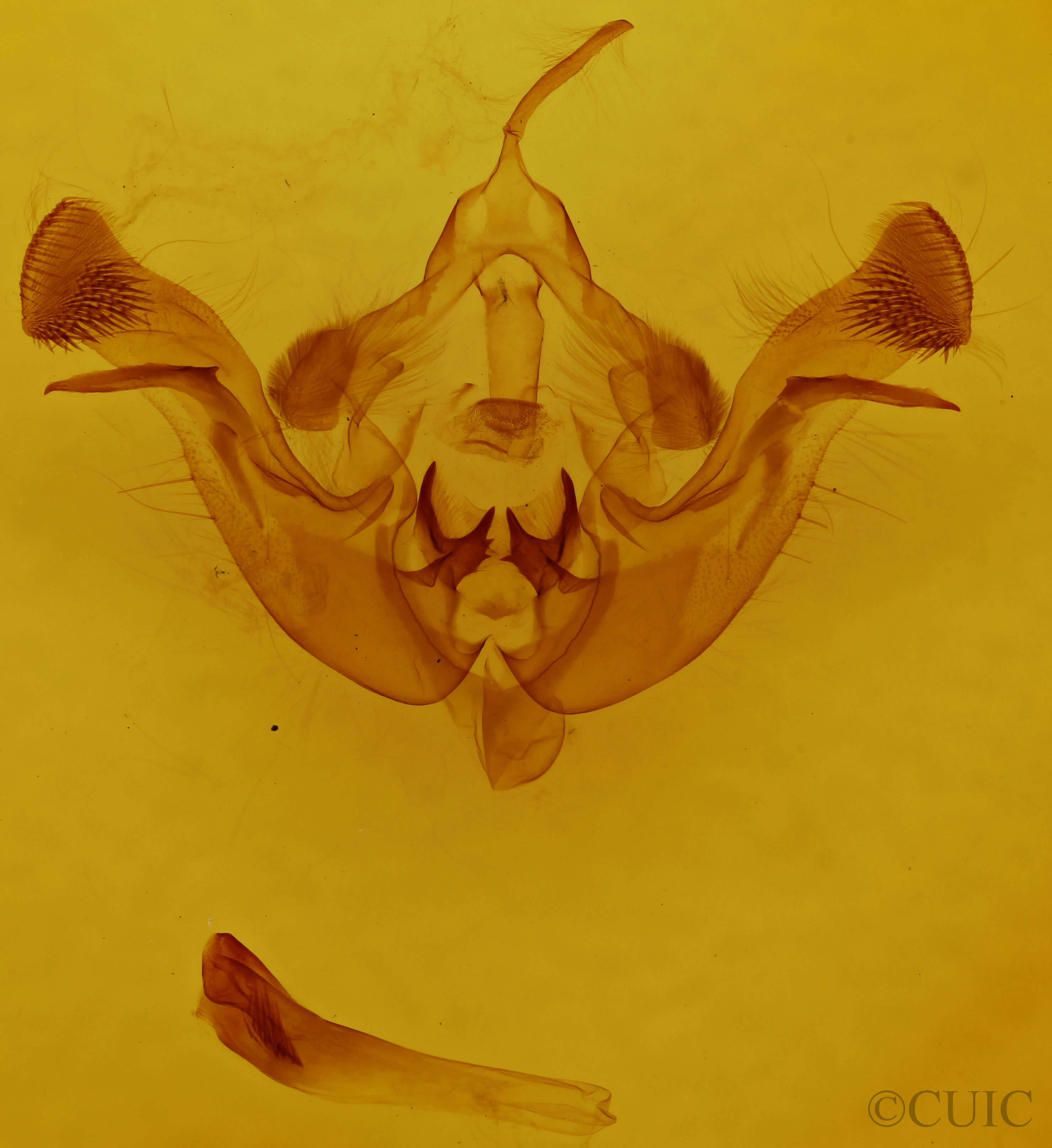 genitalia view of adult Amphipoea americana