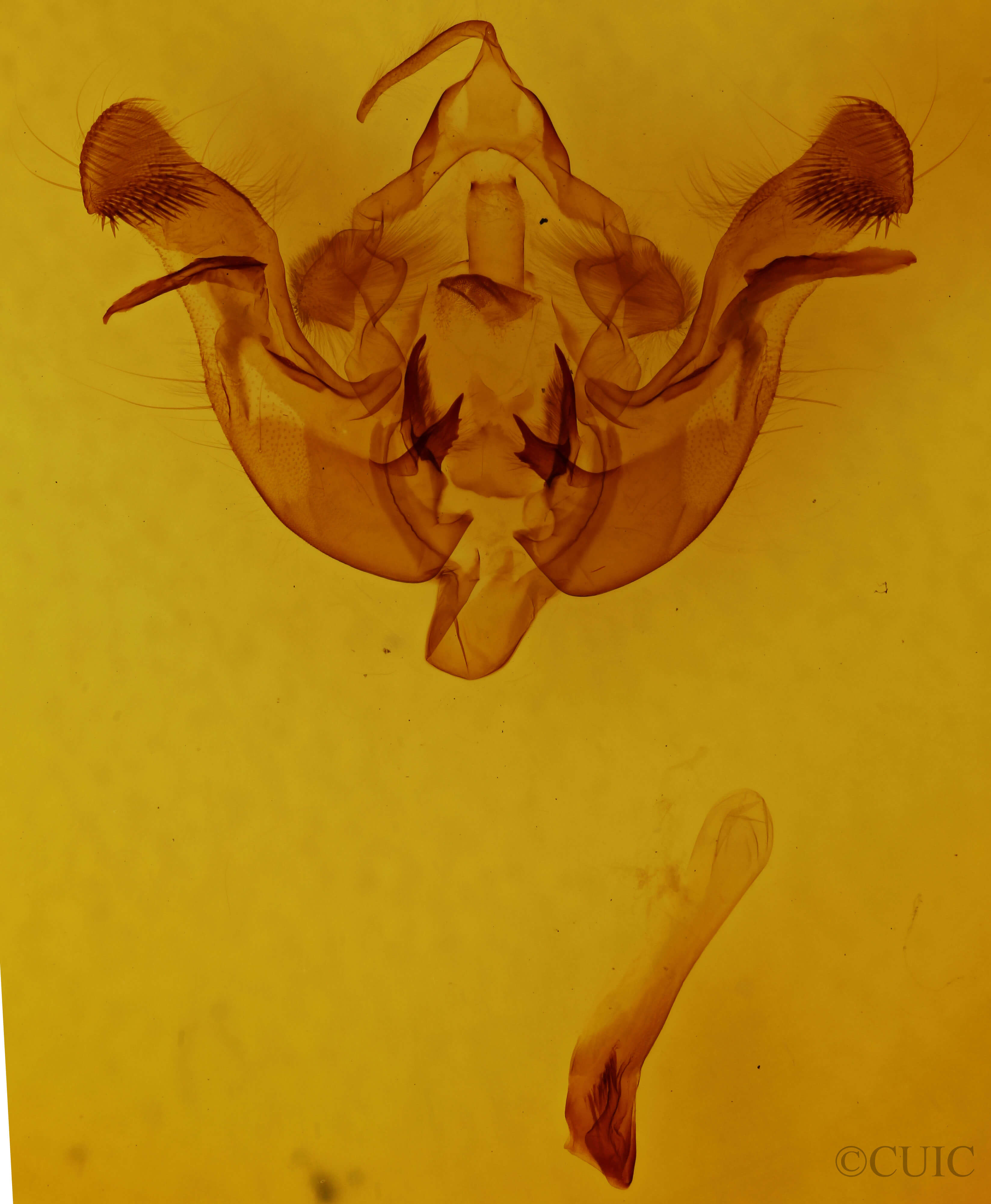 genitalia view of adult Amphipoea americana