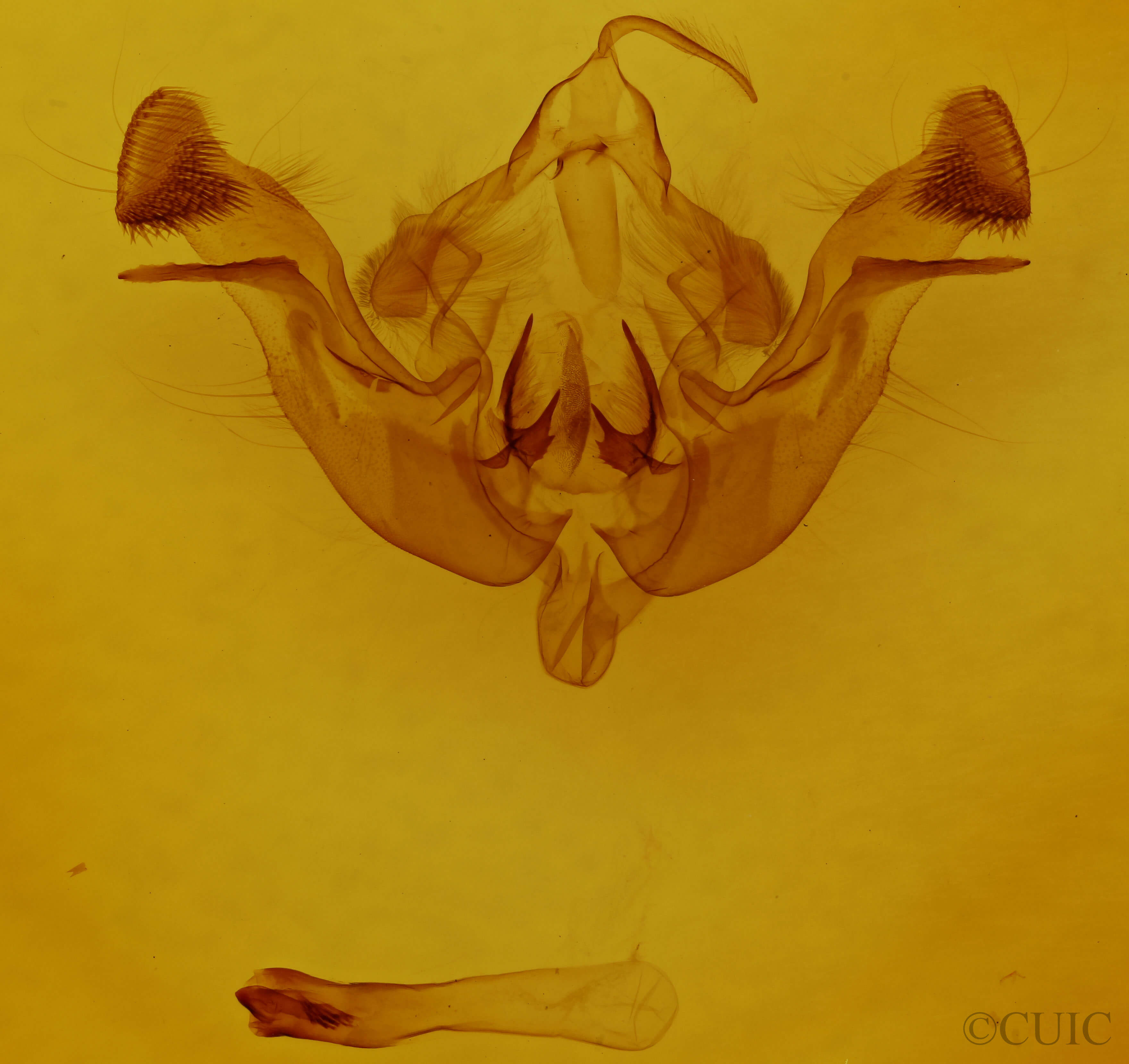 genitalia view of adult Amphipoea americana