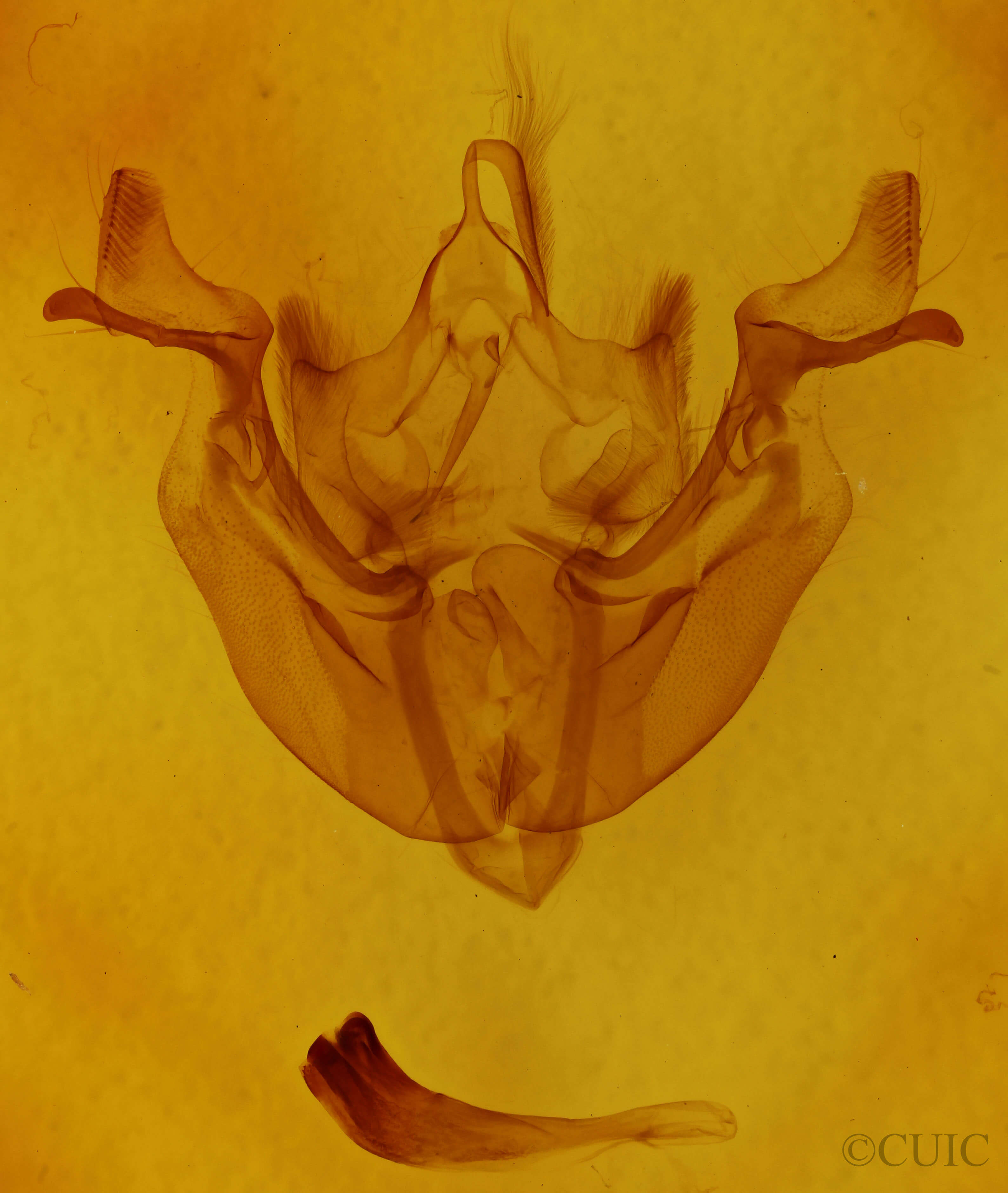 genitalia view of adult Loscopia velata