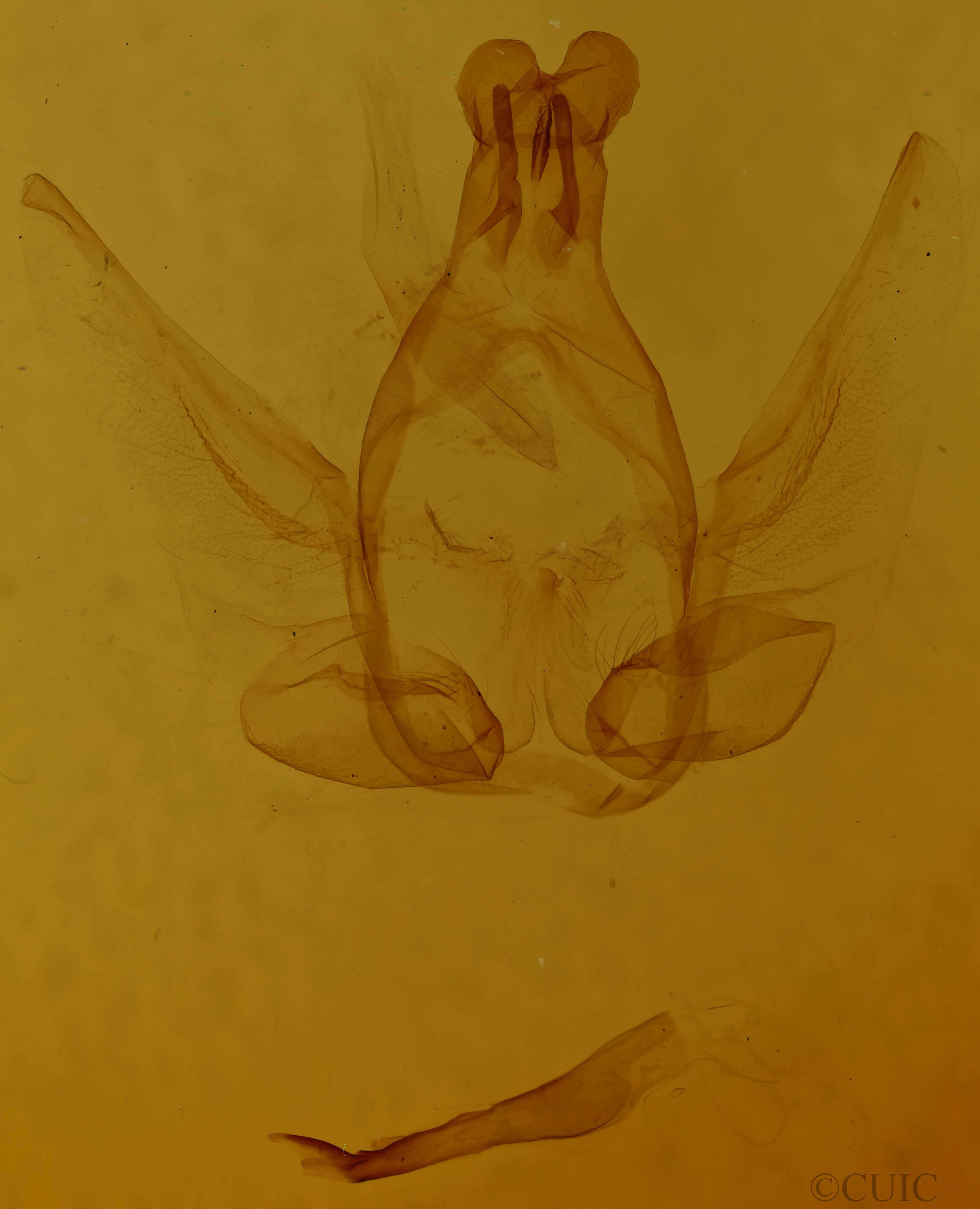 genitalia view of adult Anita basipuncta