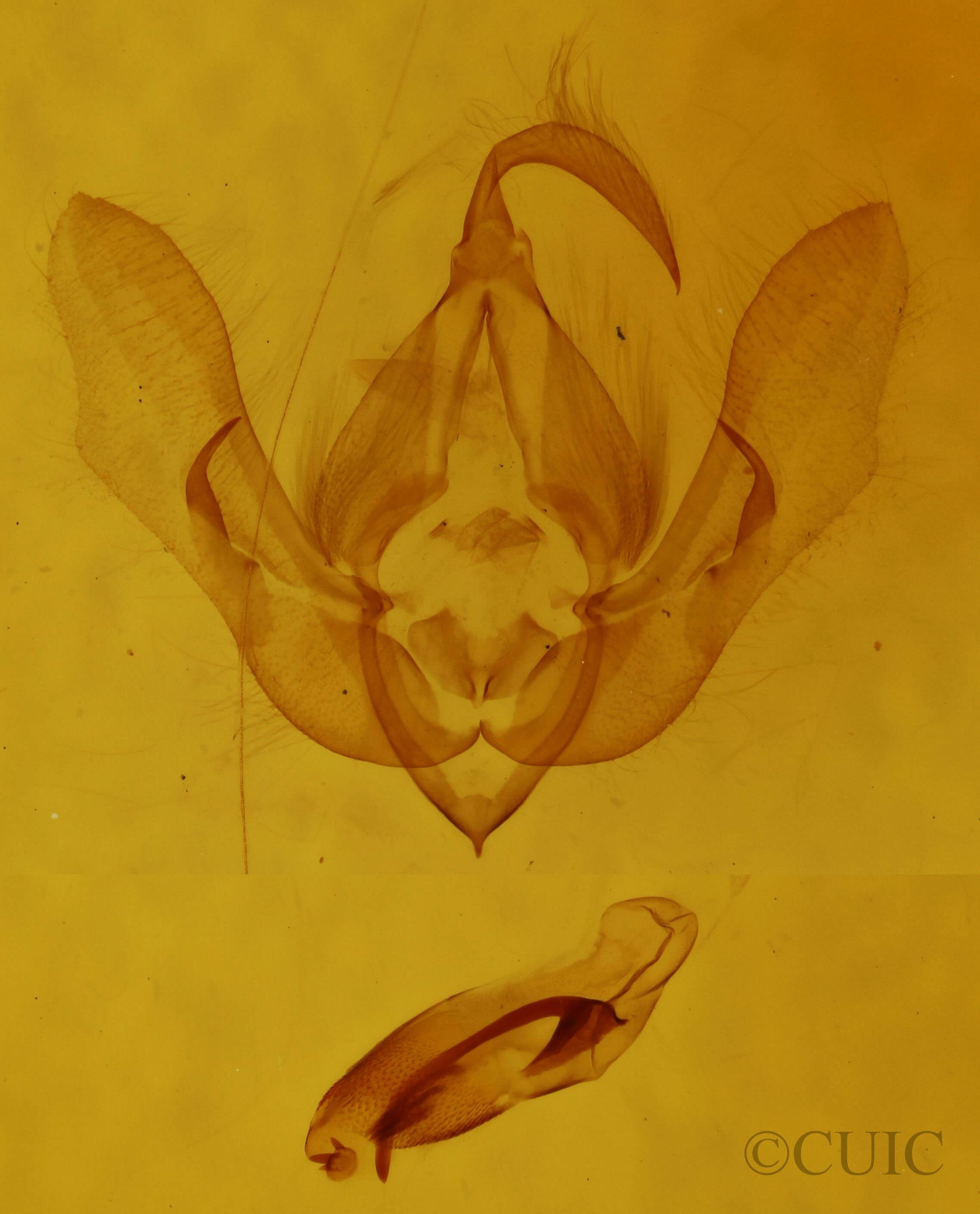 genitalia view of adult Anterastria teratophora