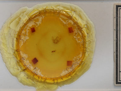 slide view of adult Anterastria teratophora