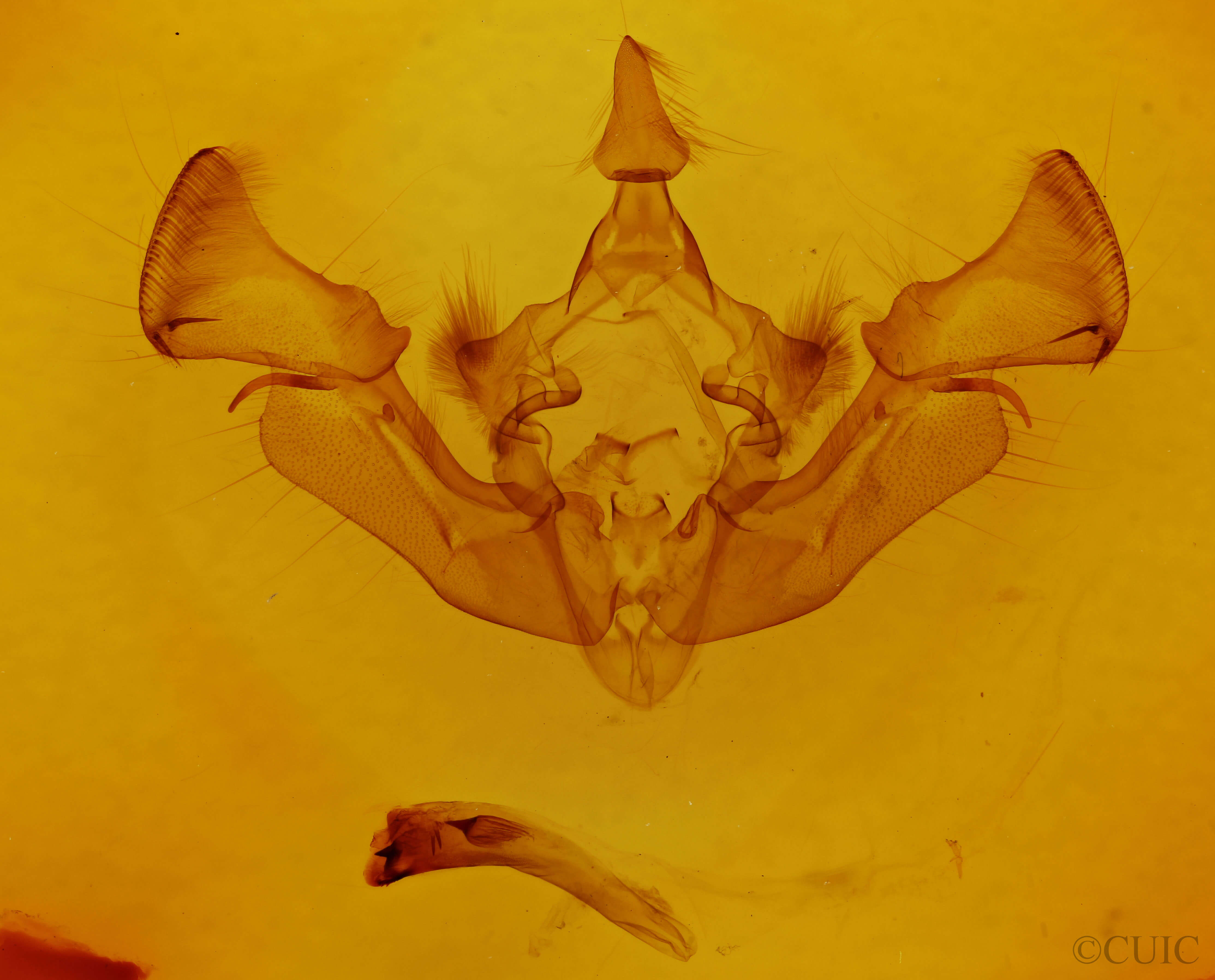 genitalia view of adult Apamea cristata