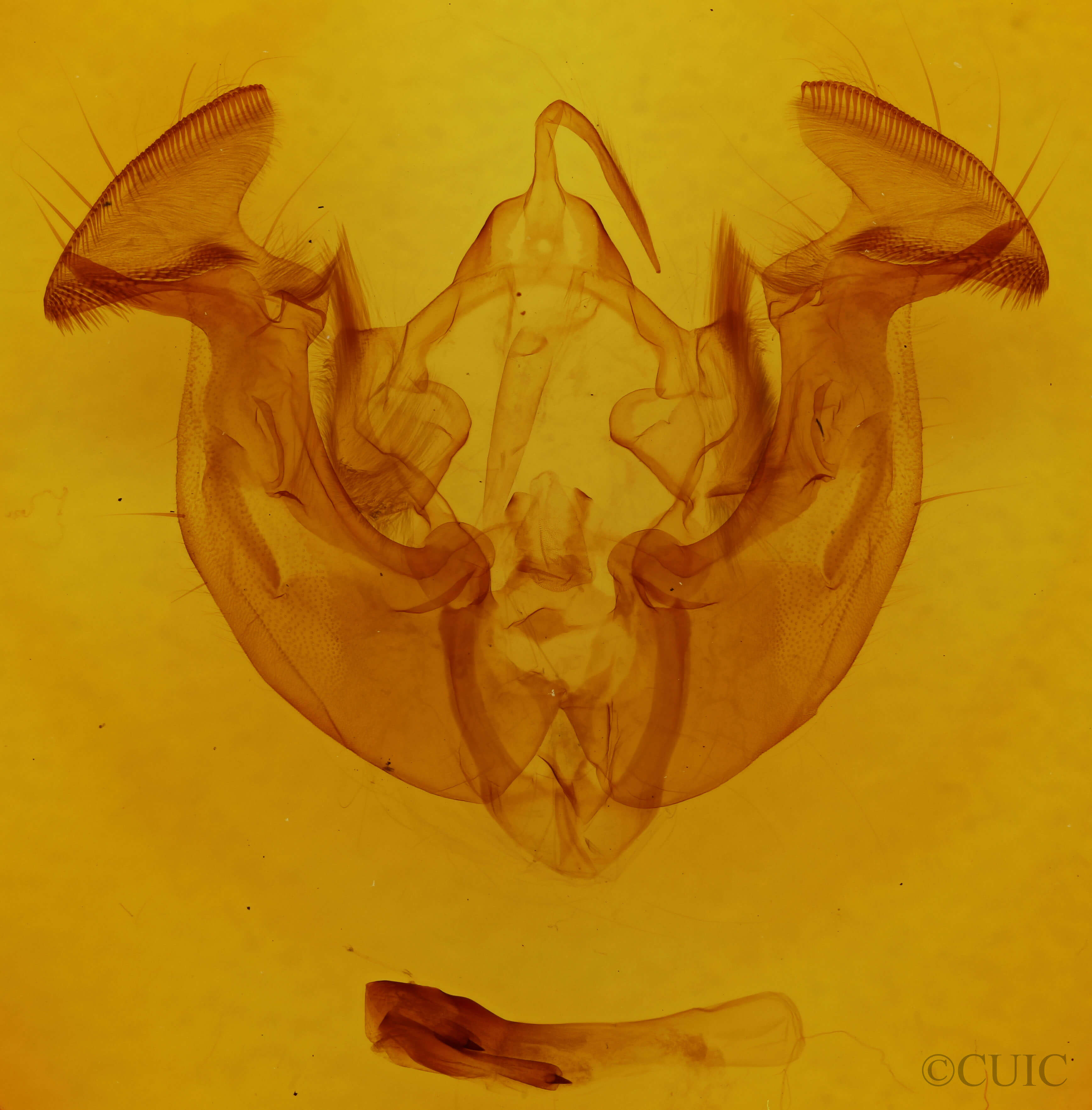 genitalia view of adult Apamea lignicolora