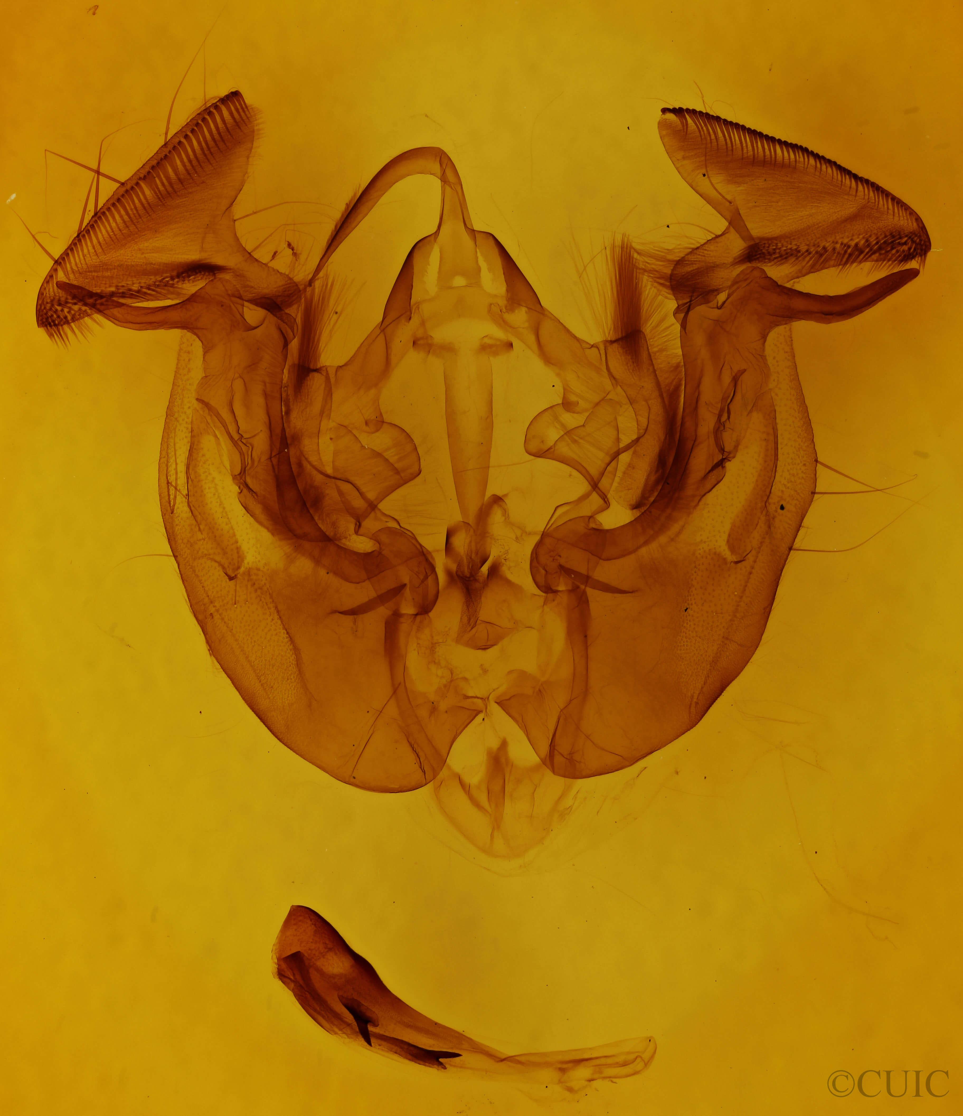 genitalia view of adult Apamea lignicolora