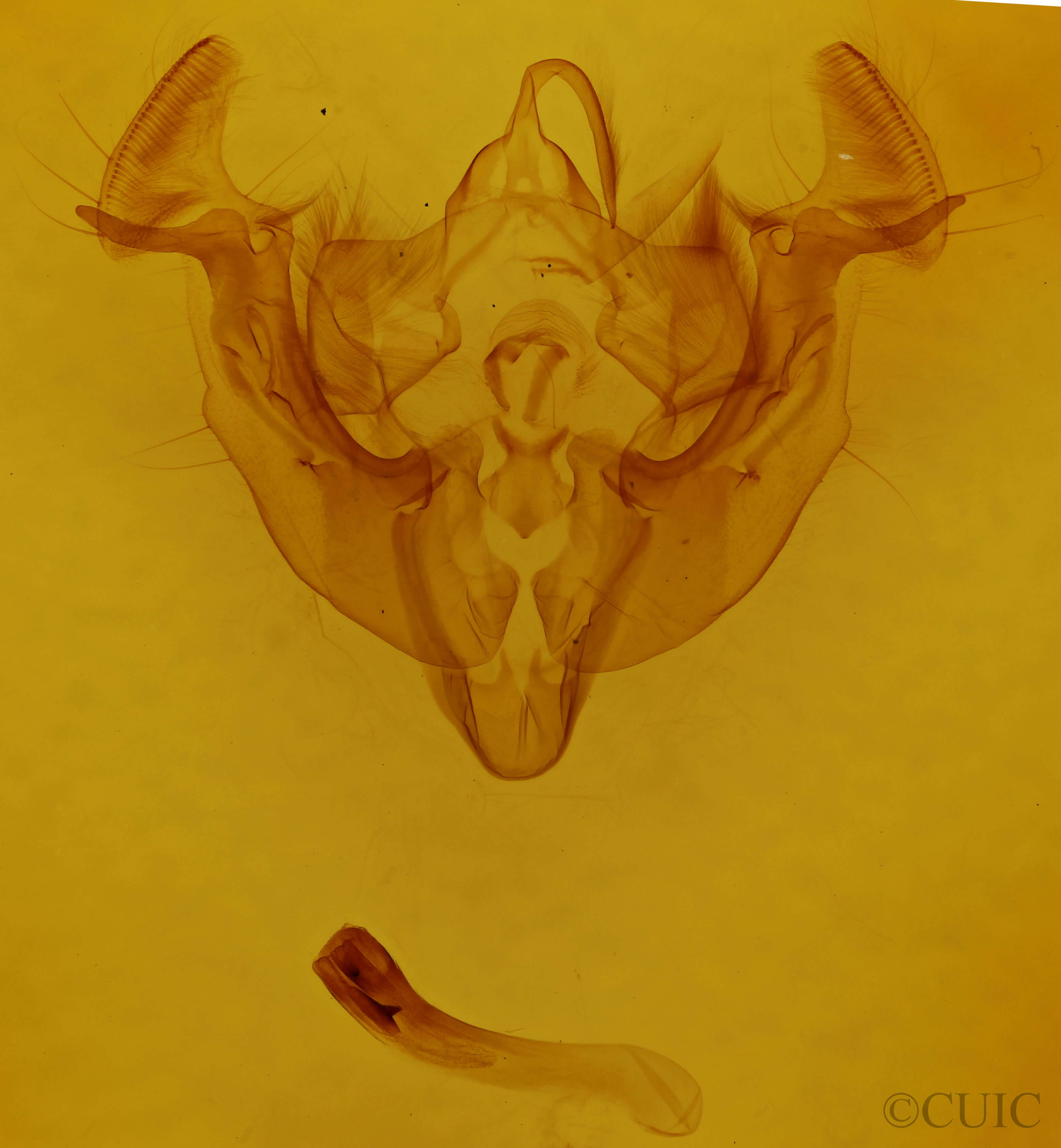 genitalia view of adult Apamea lutosa