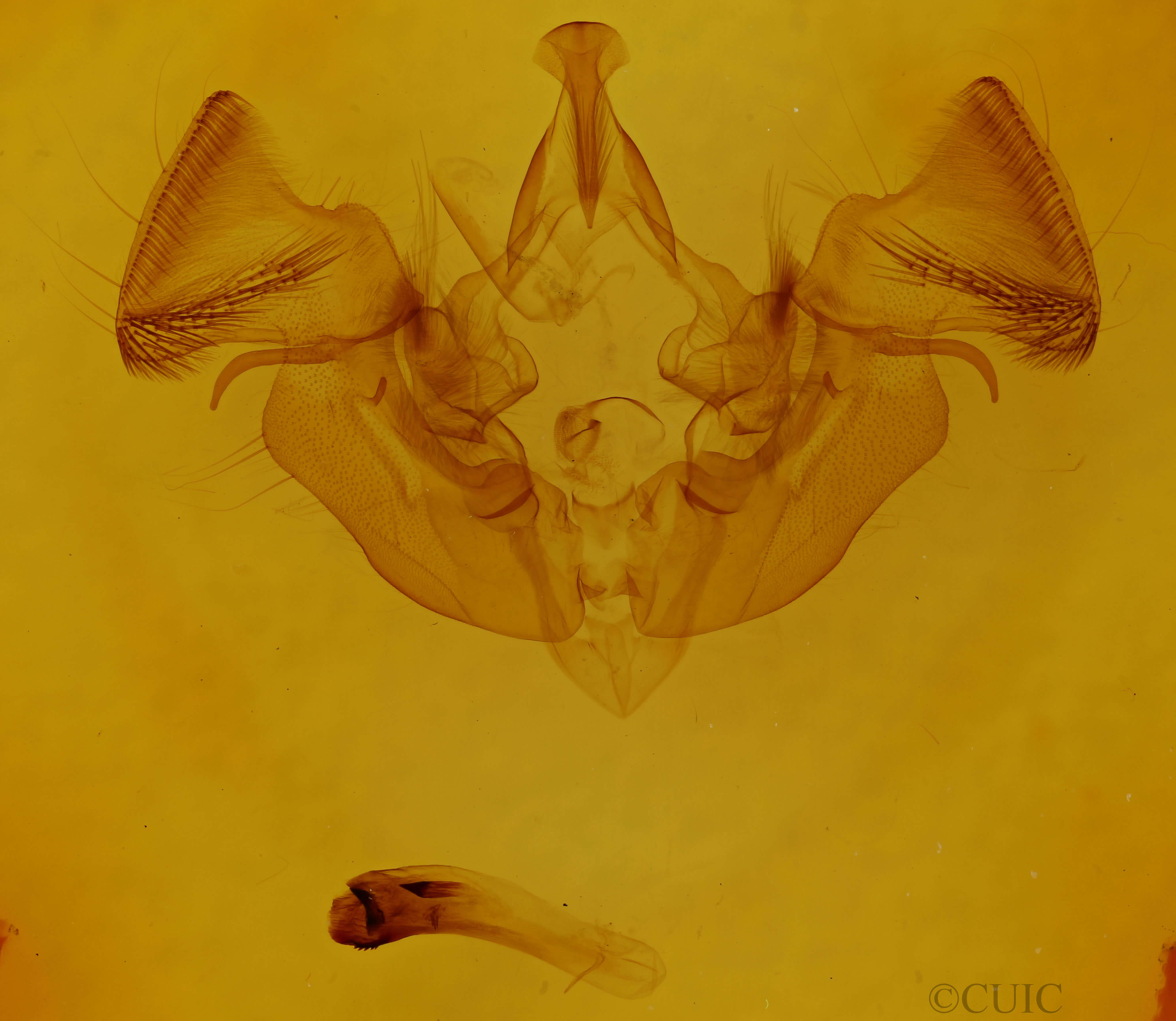 genitalia view of adult Apamea vulgaris