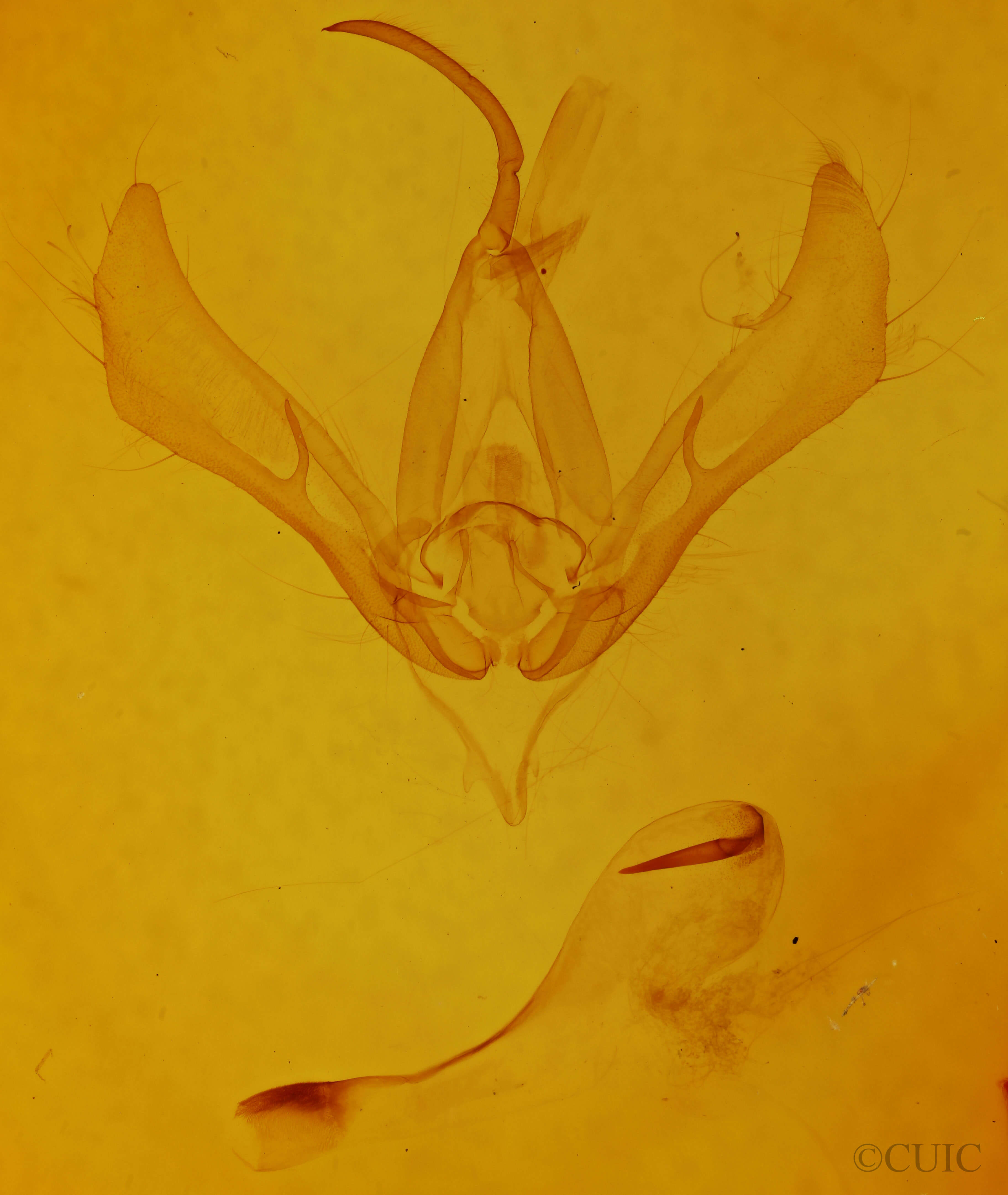 genitalia view of adult Autographa metallica