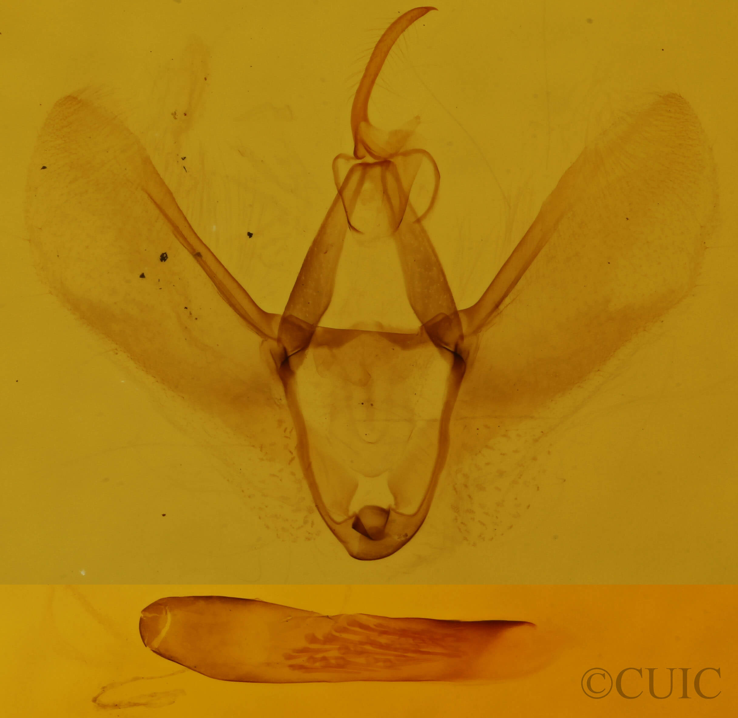 genitalia view of adult Lomographa semiclarata
