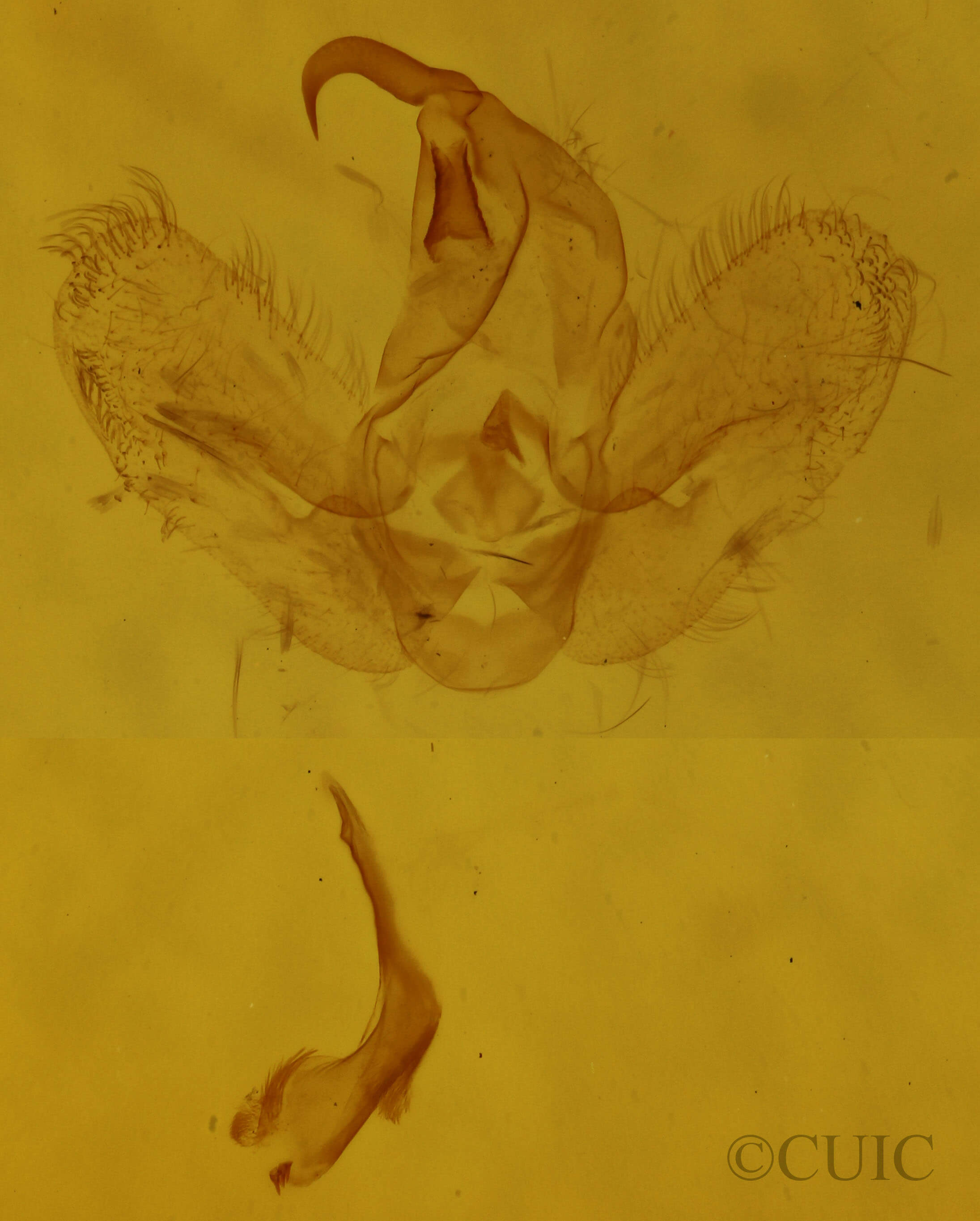 genitalia view of adult Hypena abalienalis