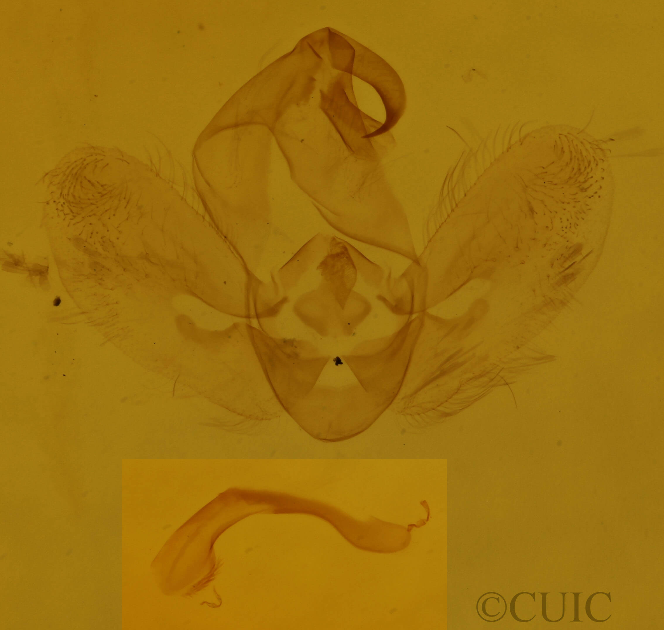 genitalia view of adult Hypena baltimoralis