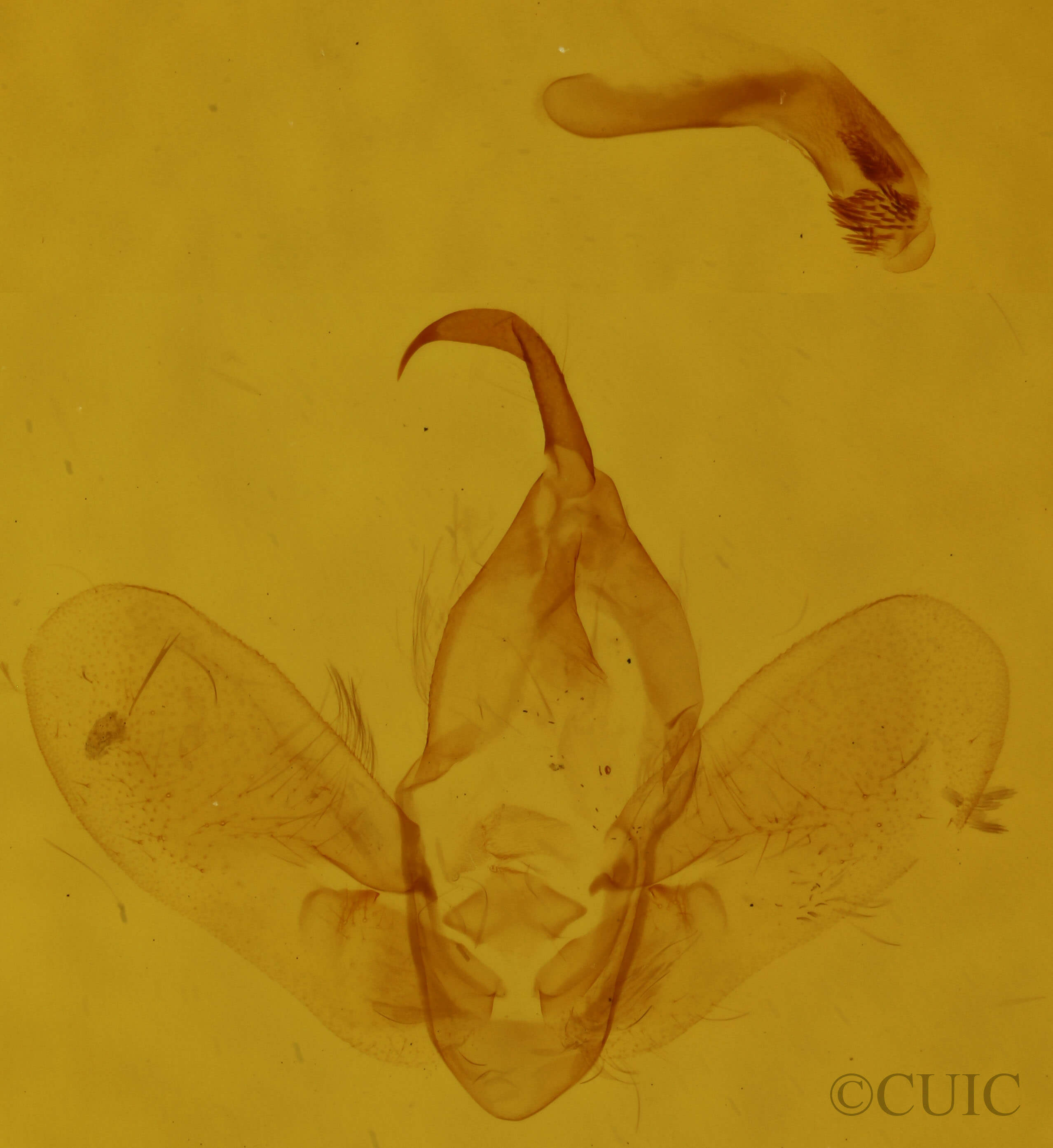 genitalia view of adult Hypena edictalis