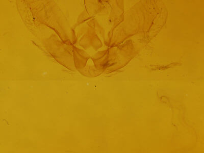 genitalia view of adult Hypena sordidula