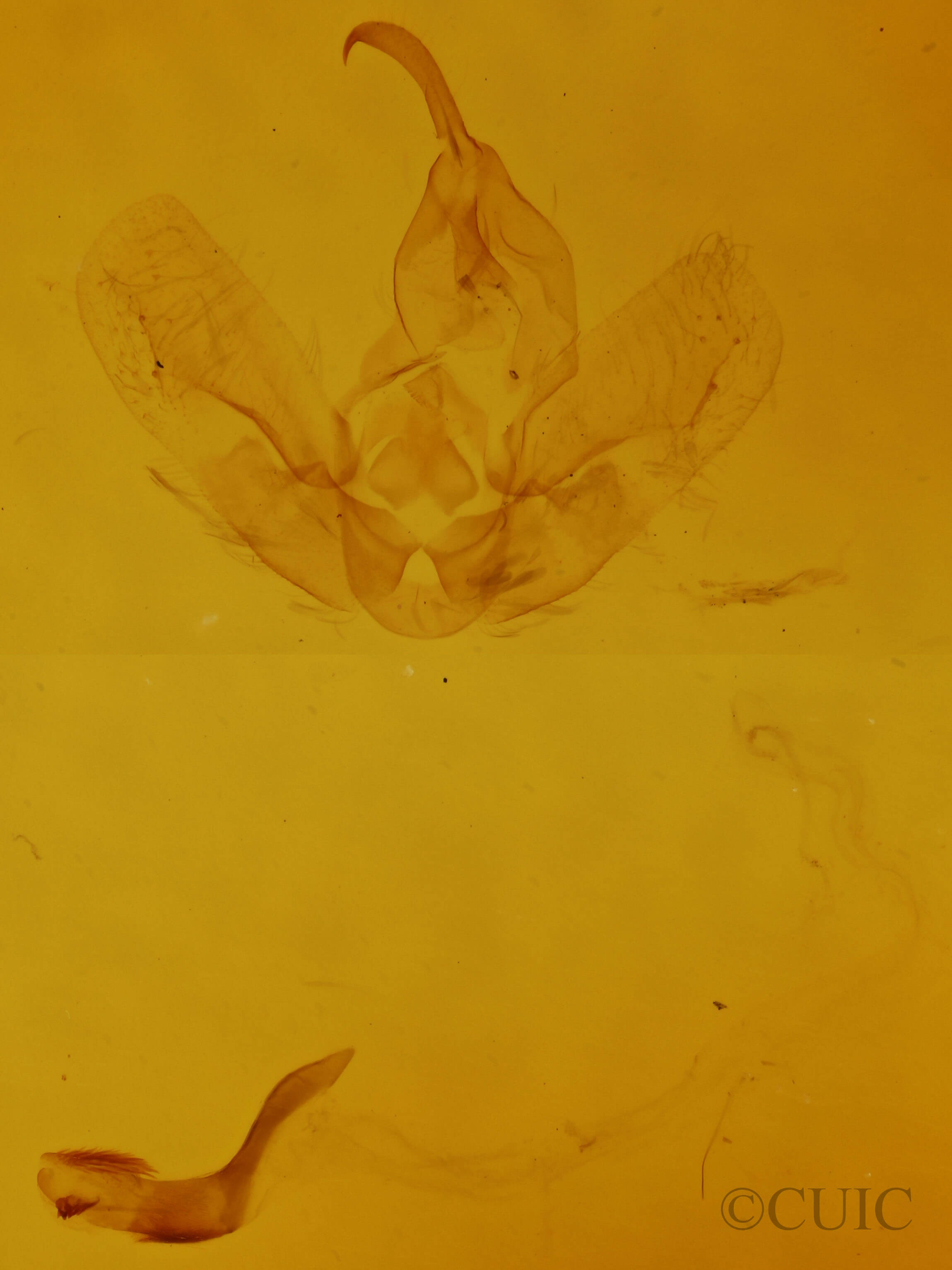 genitalia view of adult Hypena sordidula