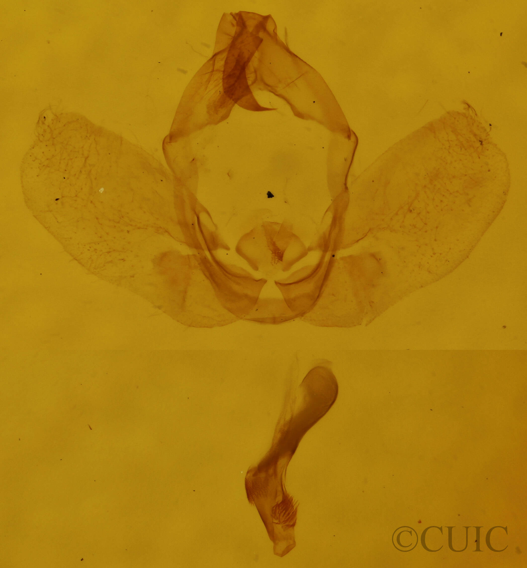 genitalia view of adult Hypena bijugalis