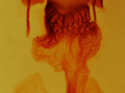 genitalia view of adult Bryomima