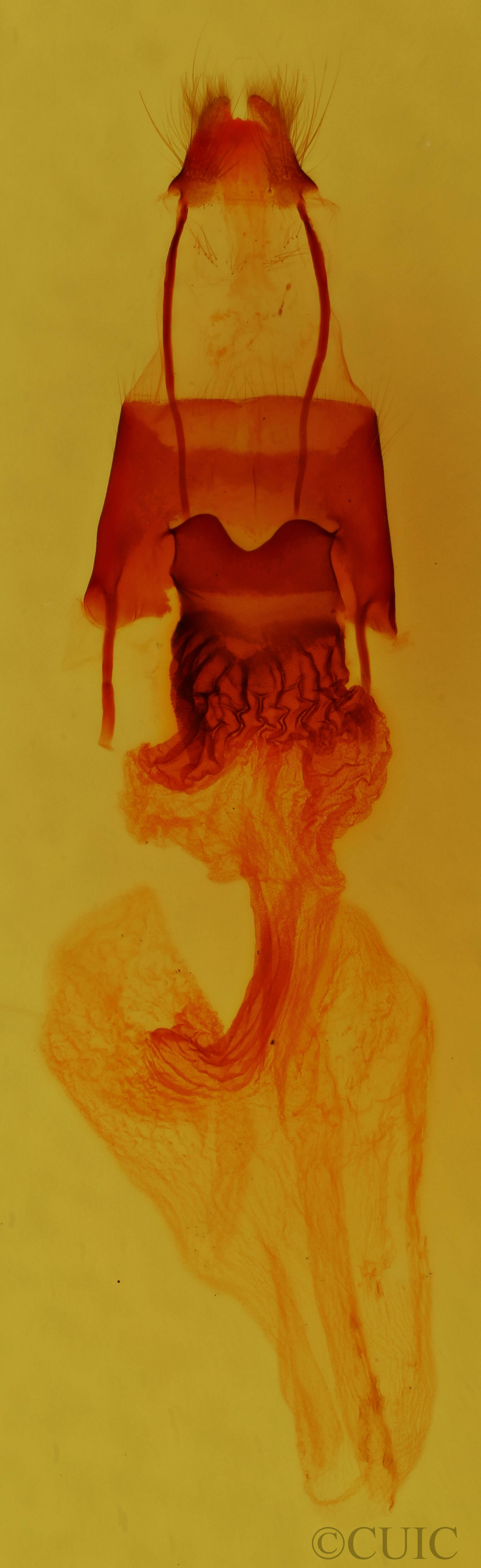 genitalia view of adult Bryomima