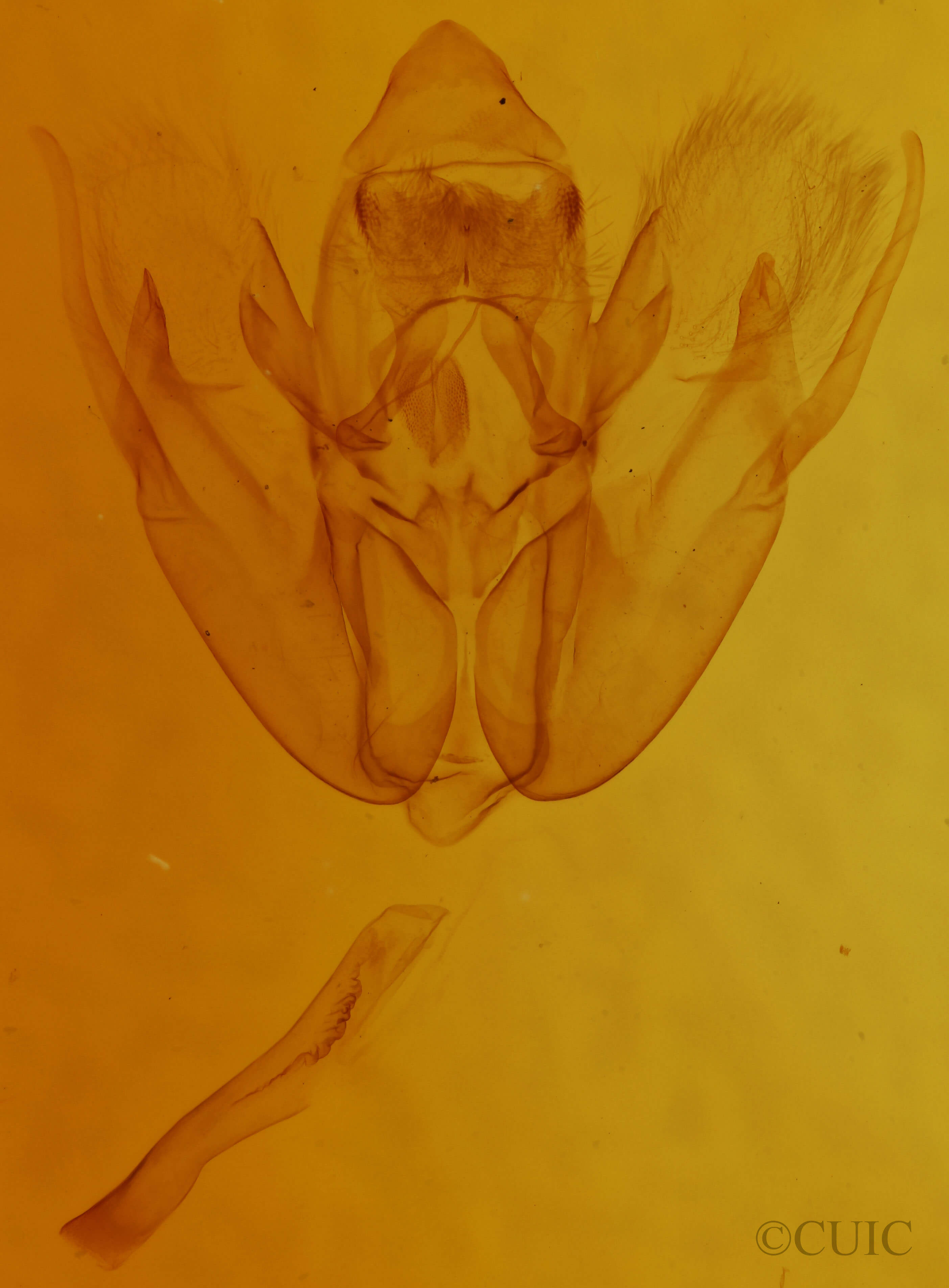 genitalia view of adult Rheumaptera undulata