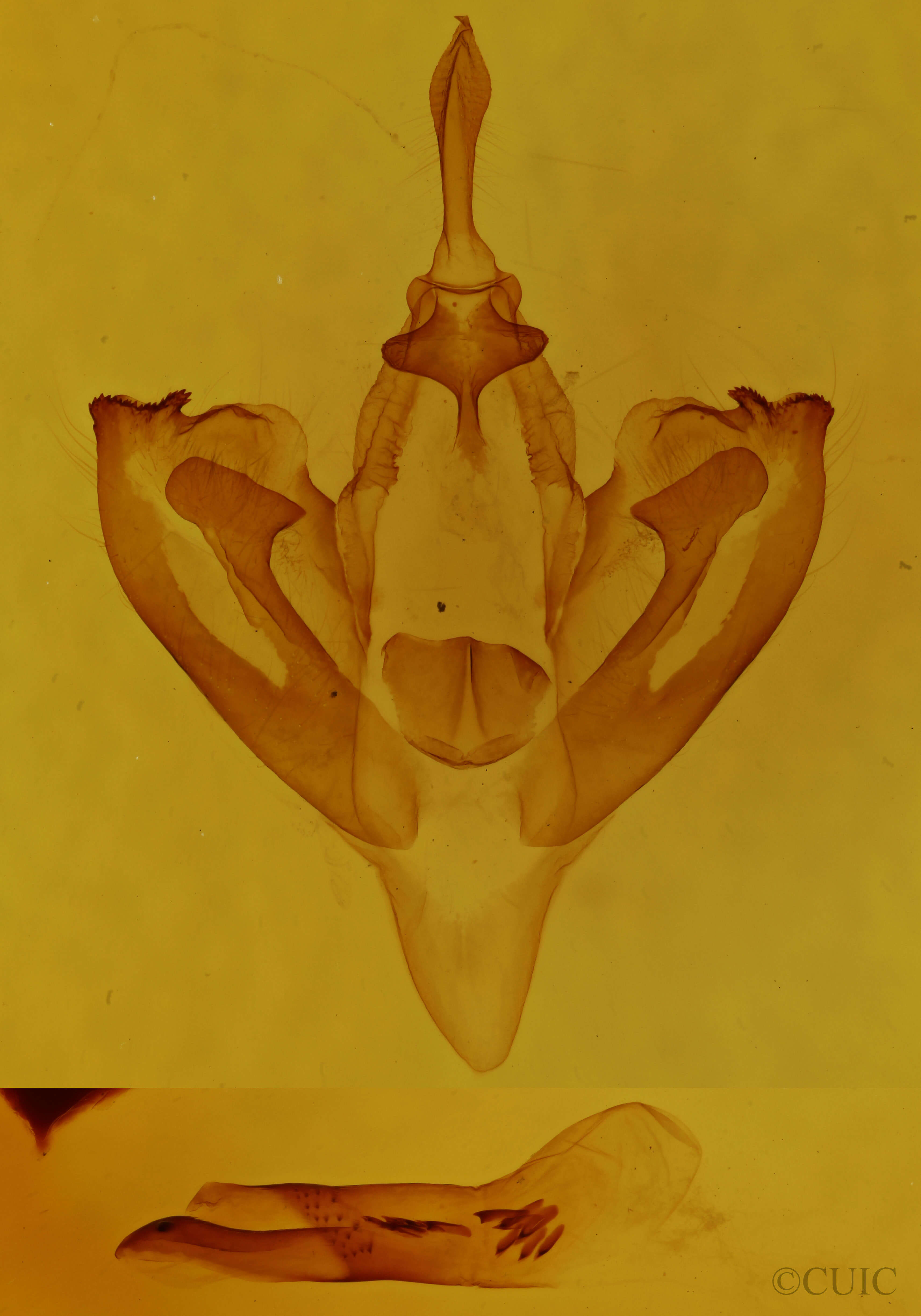 genitalia view of adult Calyptra canadensis