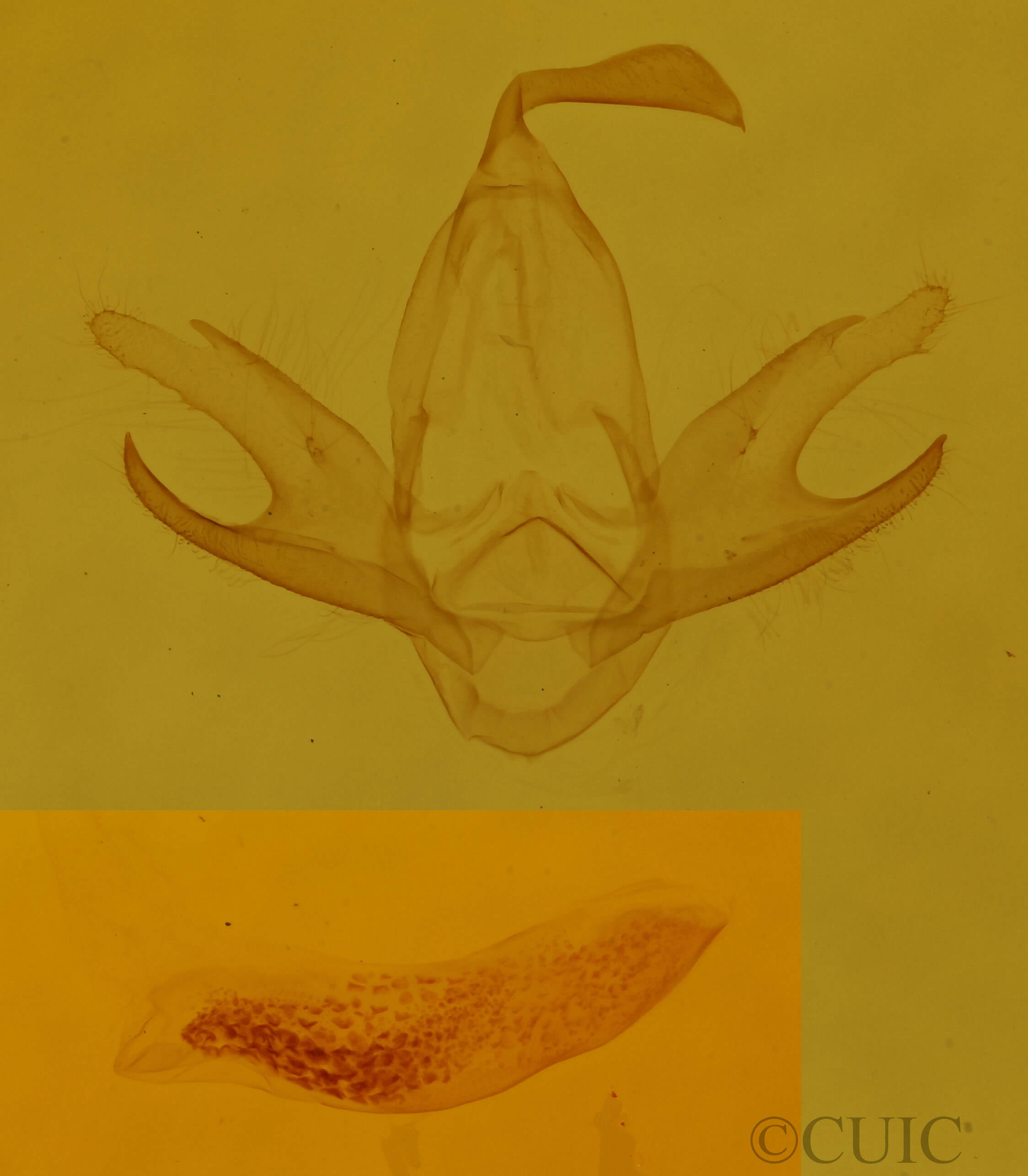 genitalia view of adult Chytolita morbidalis