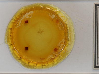 slide view of adult Chytolita morbidalis