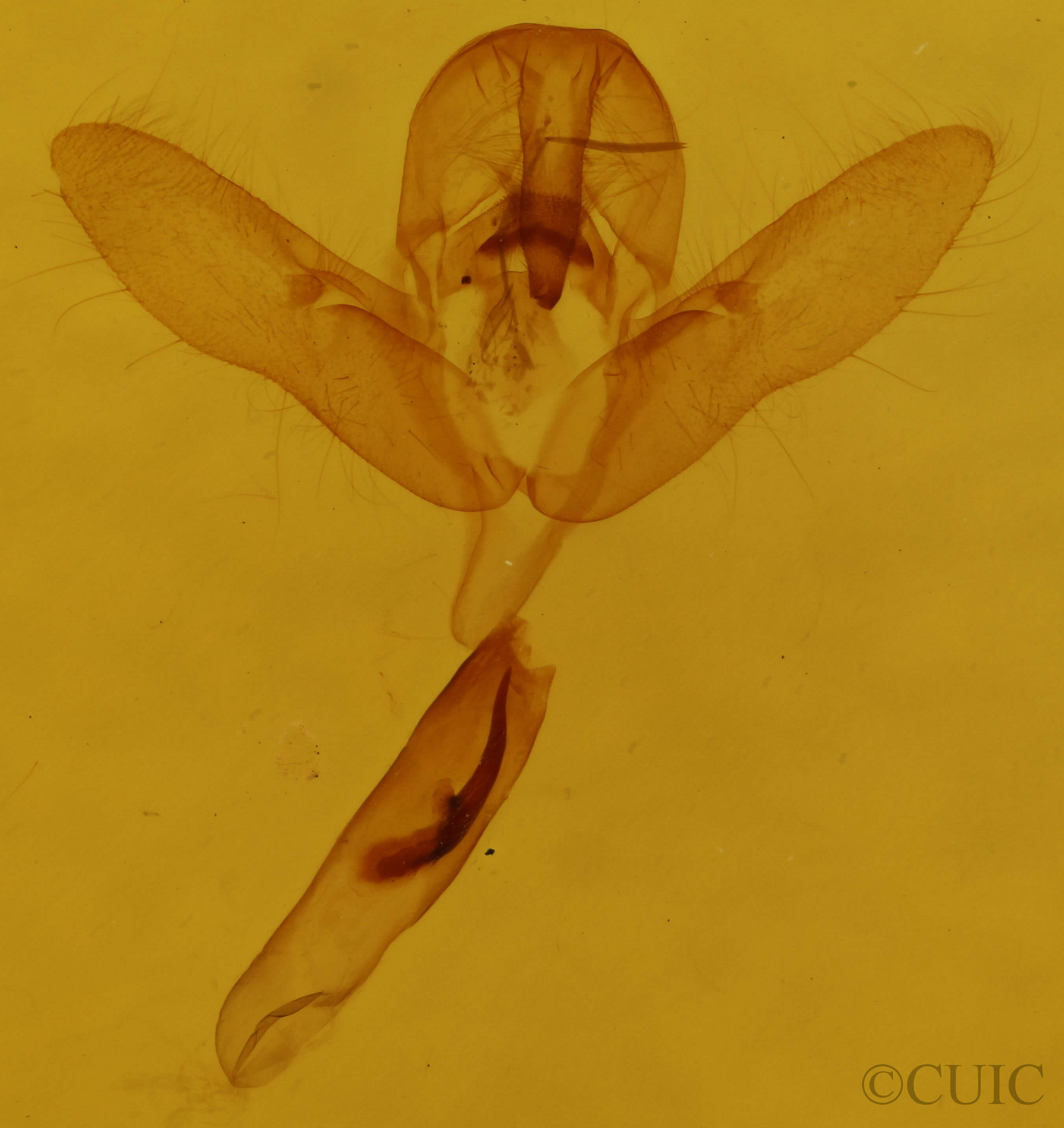 genitalia view of adult Cosmia calami