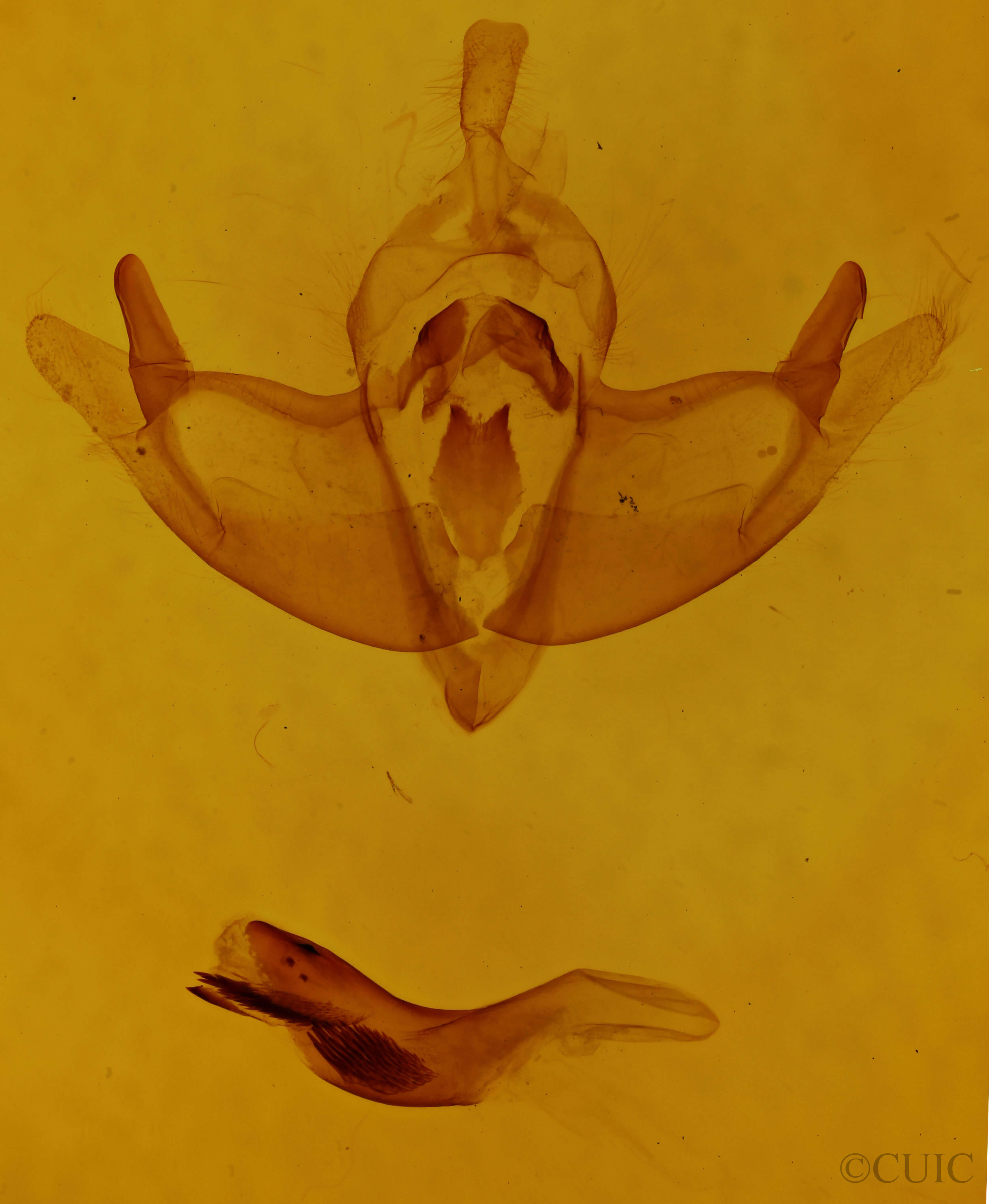 genitalia view of adult Episema tersa