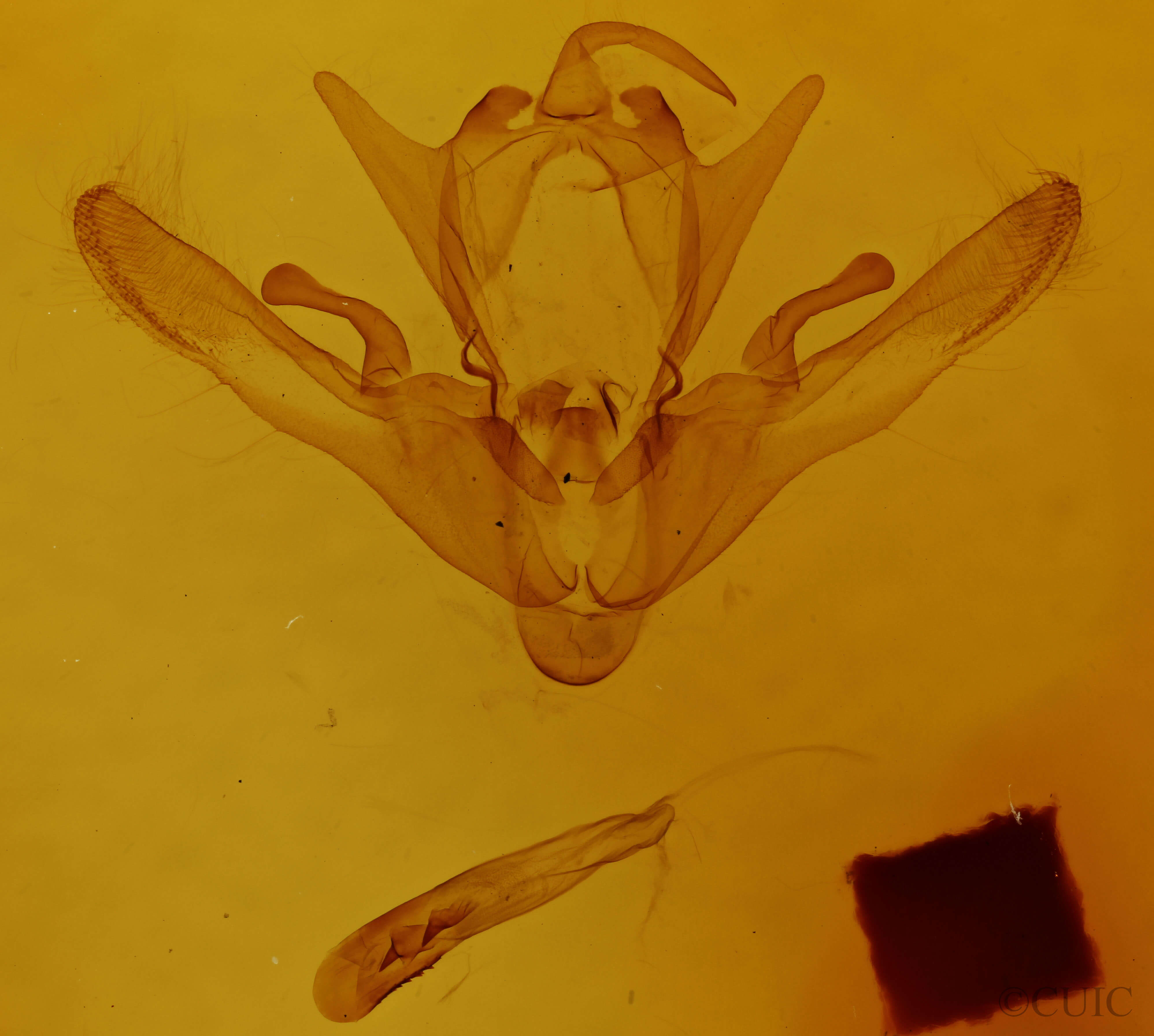 genitalia view of adult Enargia sp.