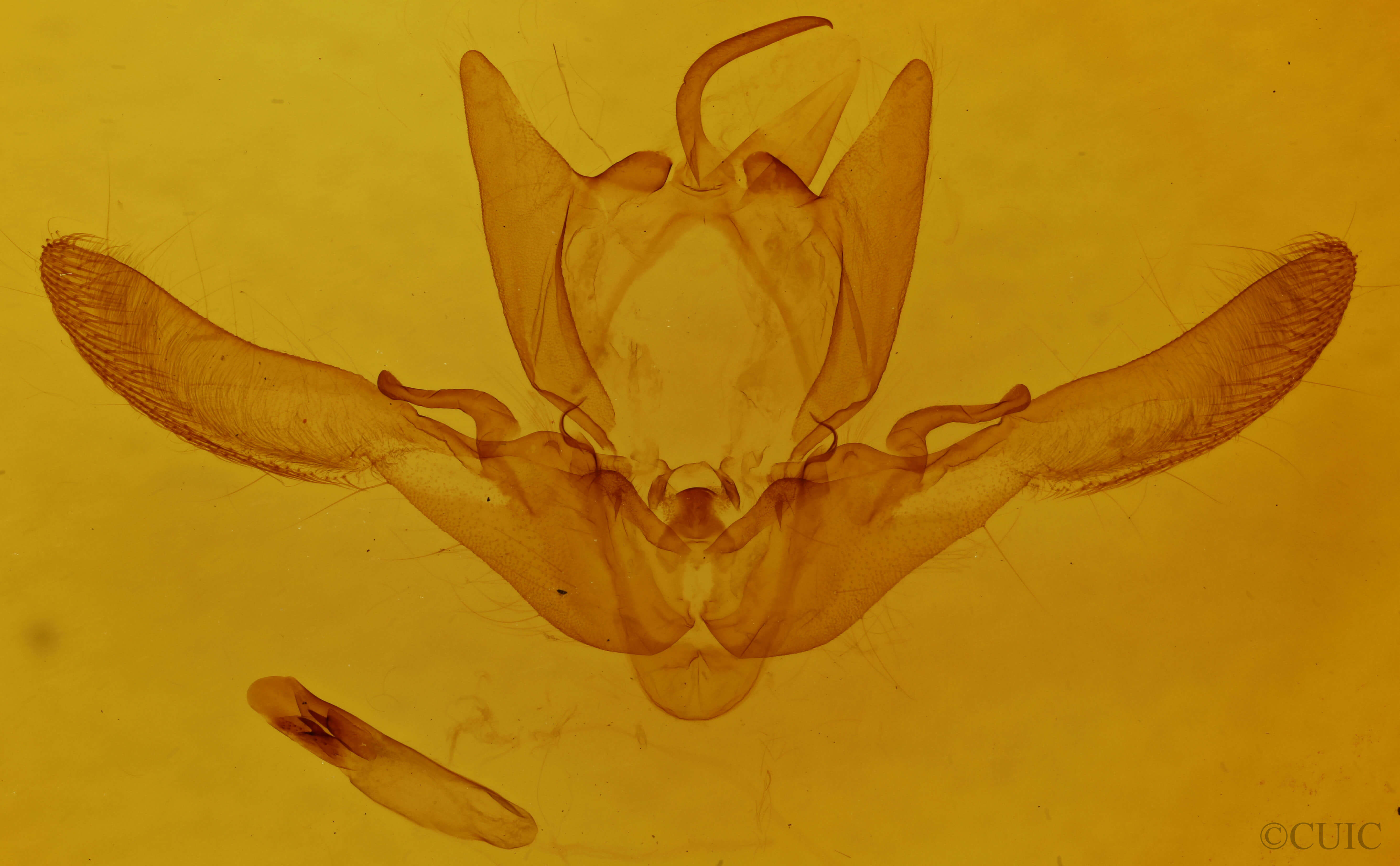 genitalia view of adult Enargia sp.