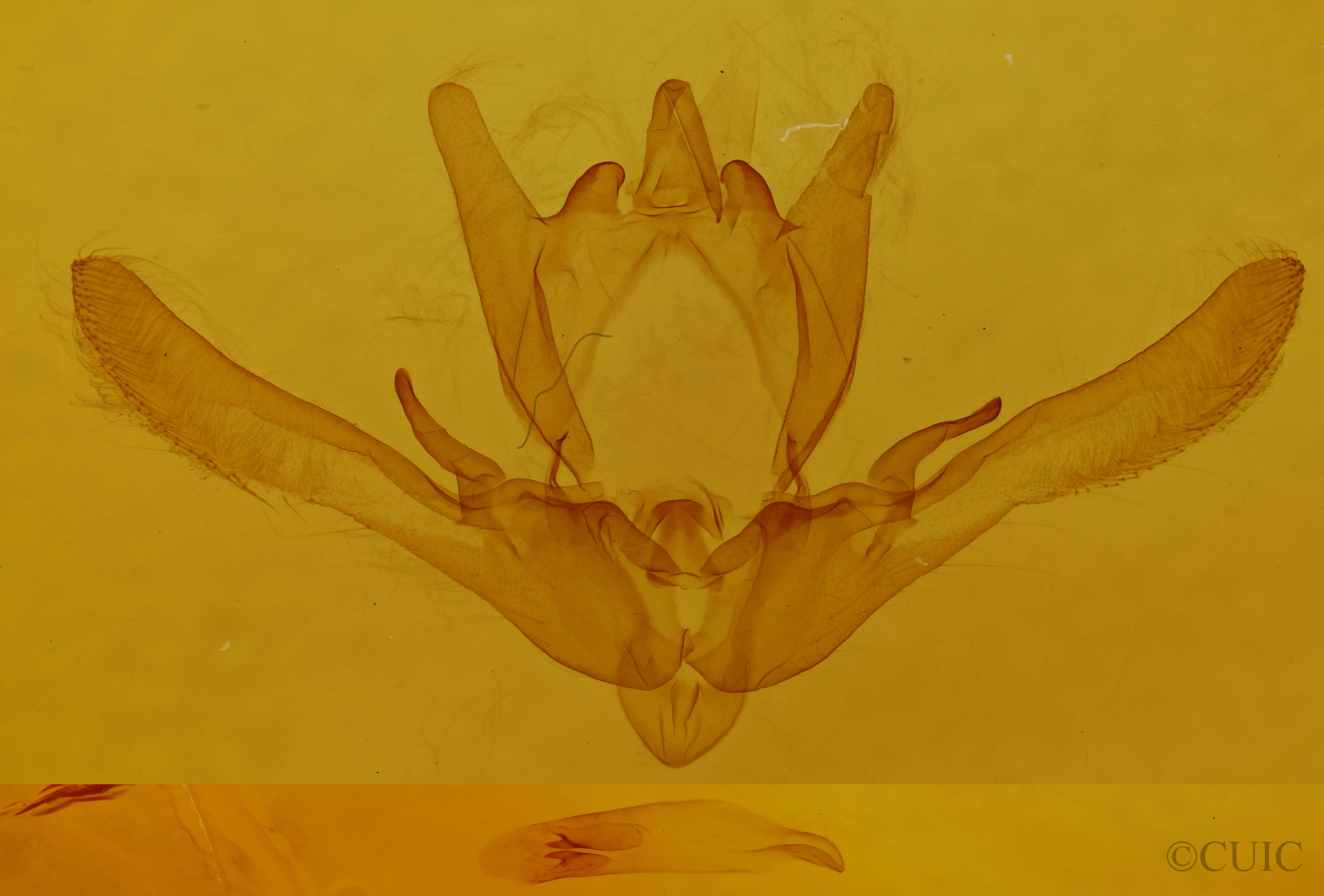 genitalia view of adult Enargia infumata