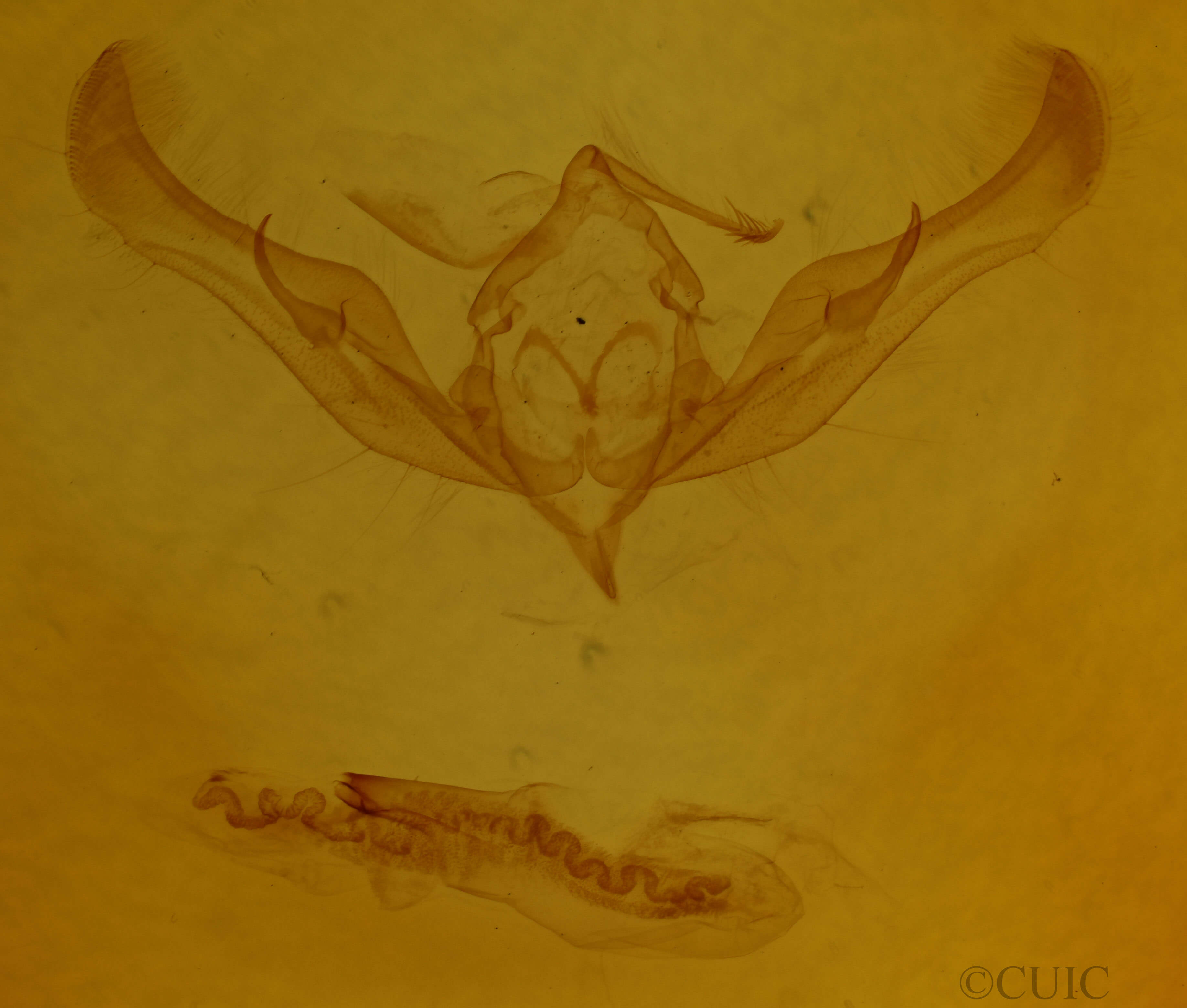 genitalia view of adult Anicla illapsa