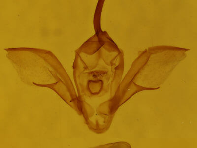 genitalia view of adult Costaconvexa centrostrigaria