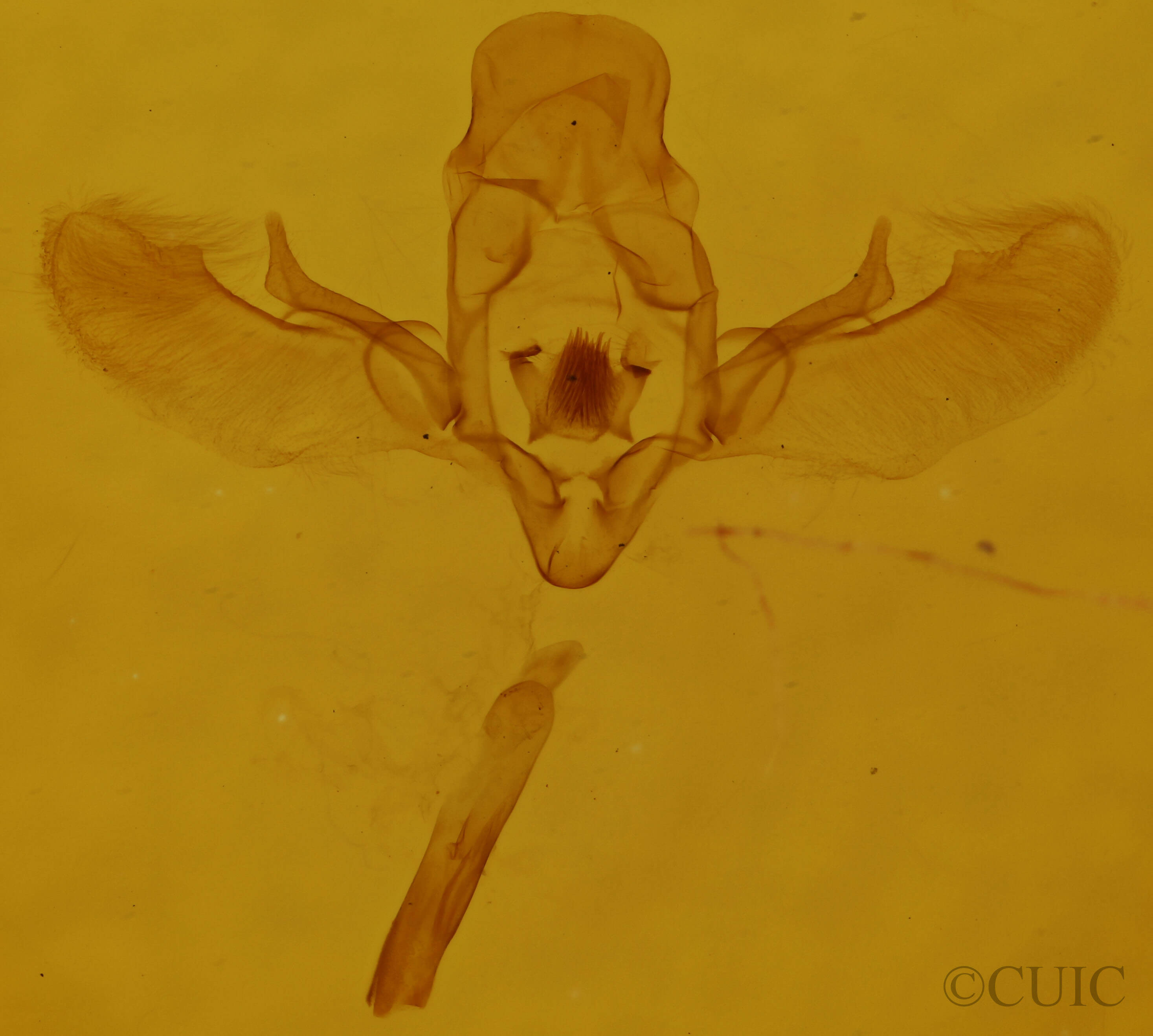 genitalia view of adult Euphyia intermediata