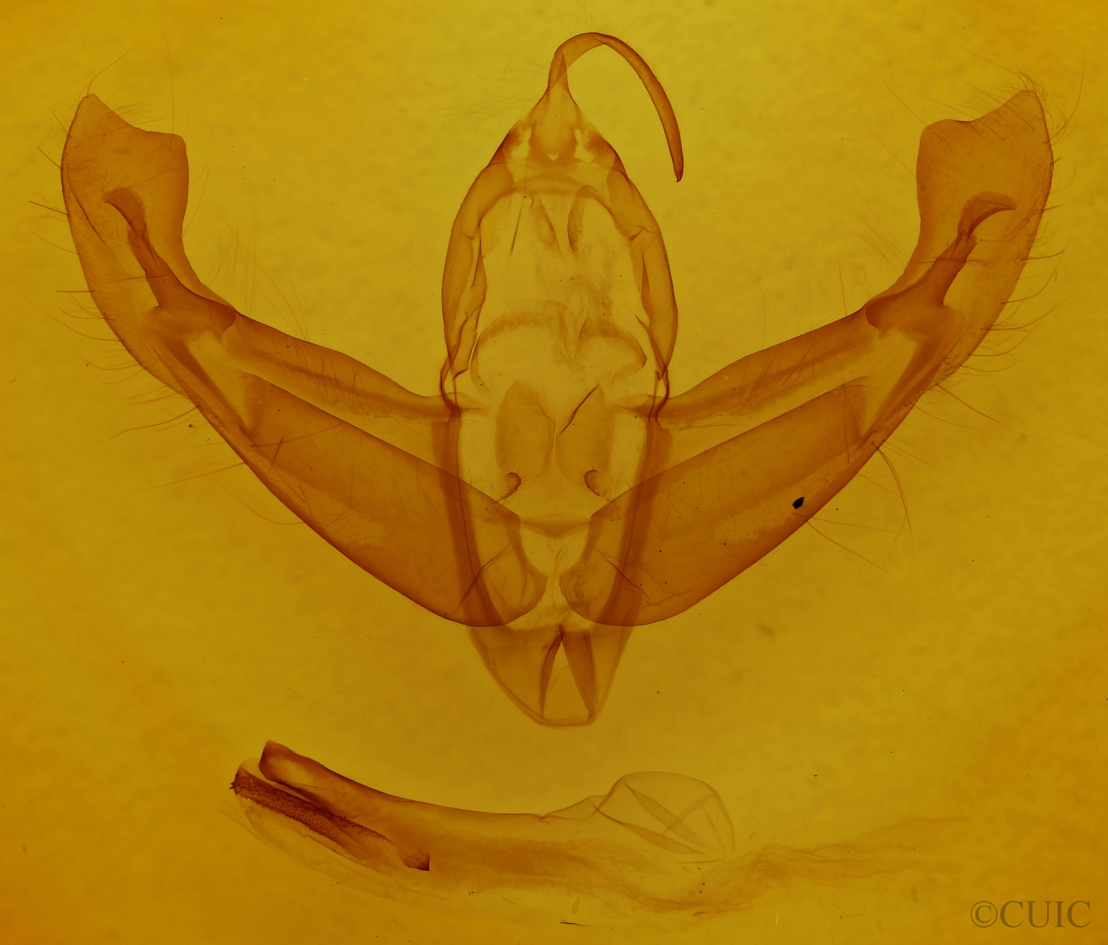 genitalia view of adult Eurois occulta