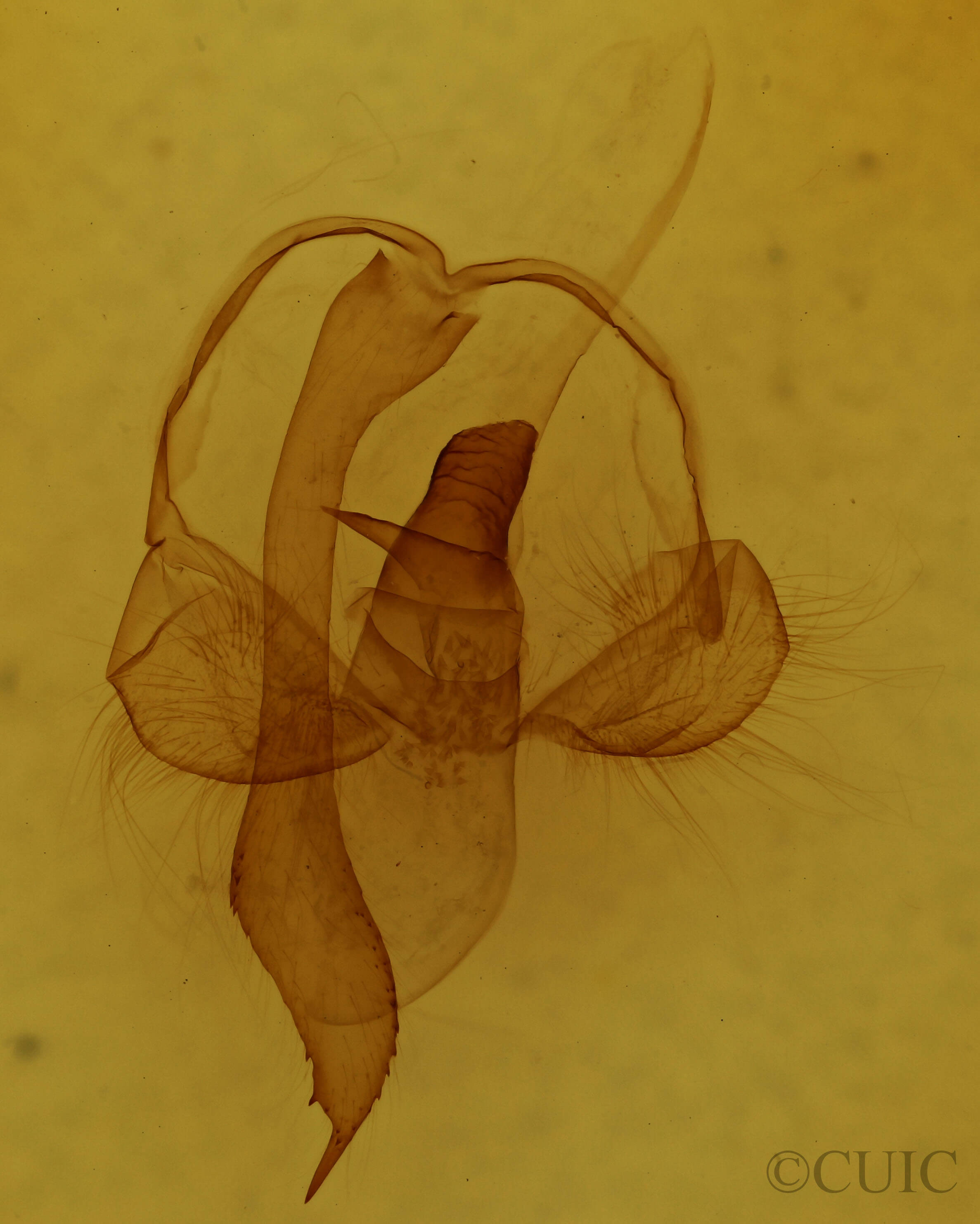 genitalia view of adult Toulgoetigia catharina
