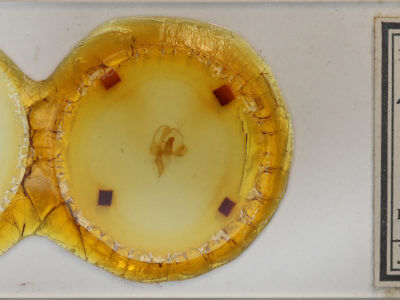 slide view of adult Toulgoetigia catharina