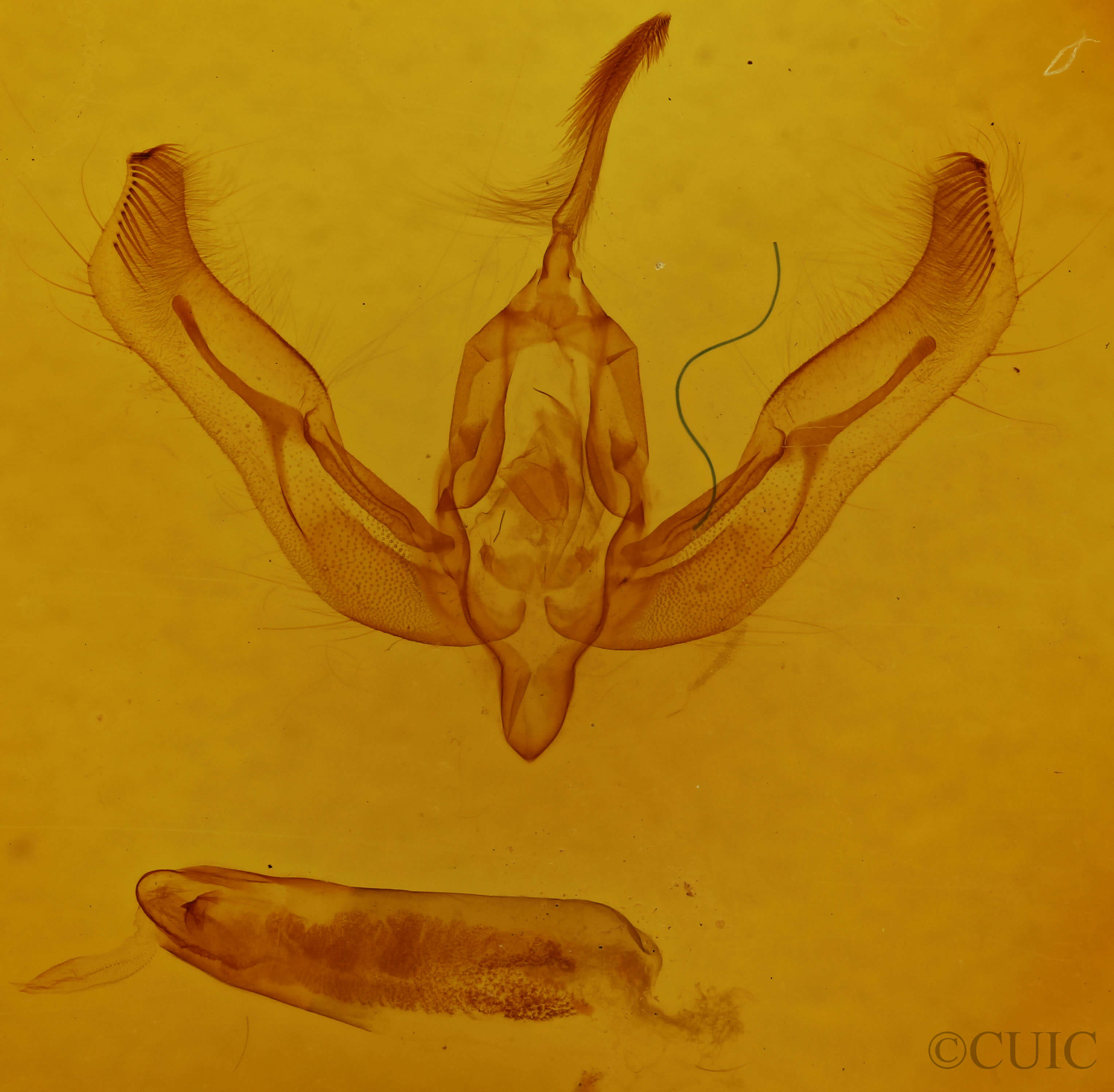 genitalia view of adult Feltia
