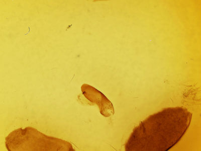 genitalia view of adult Furcula cinerea