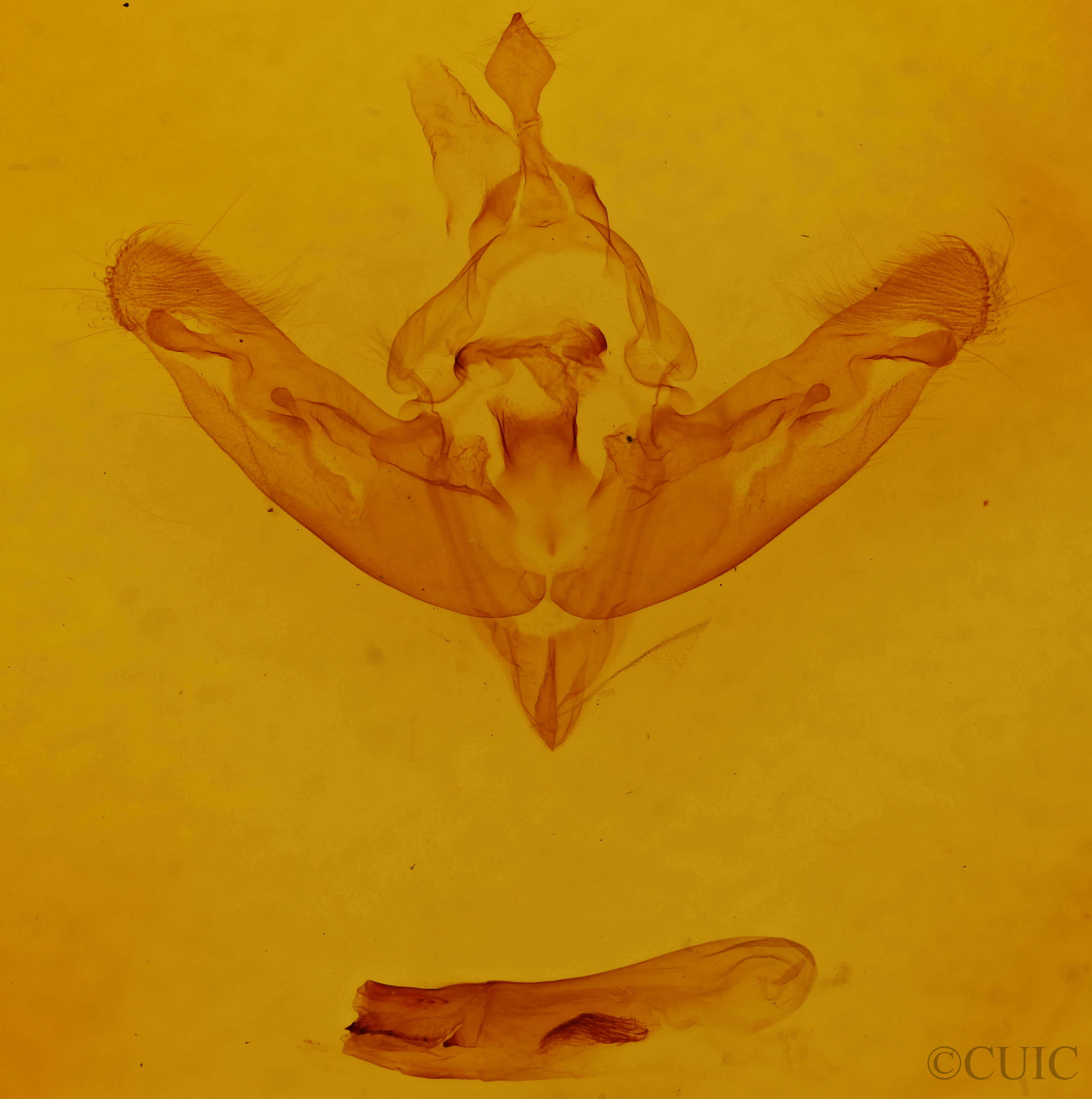 genitalia view of adult Gortyna flavago