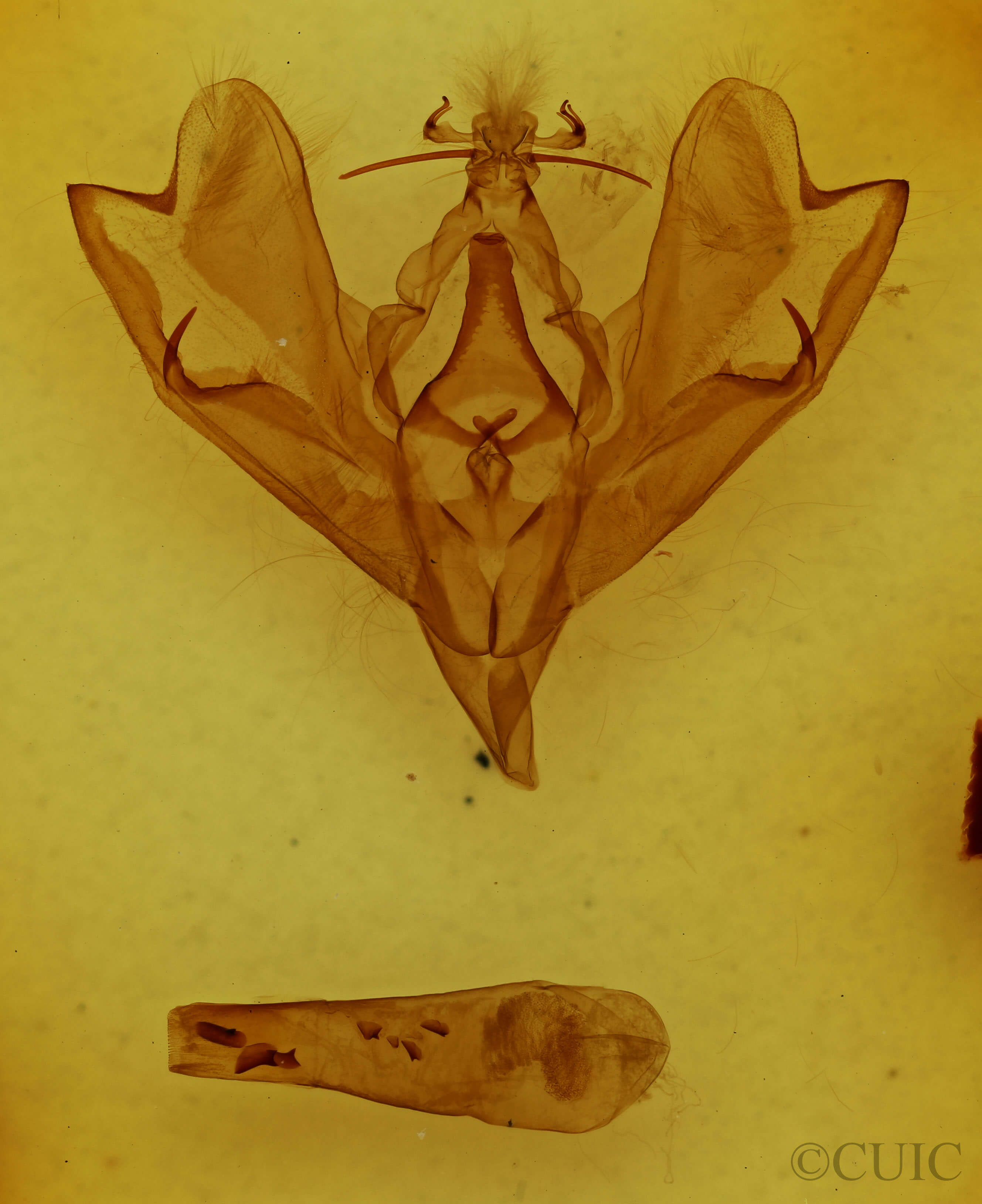 genitalia view of adult Hemicephalis sp.