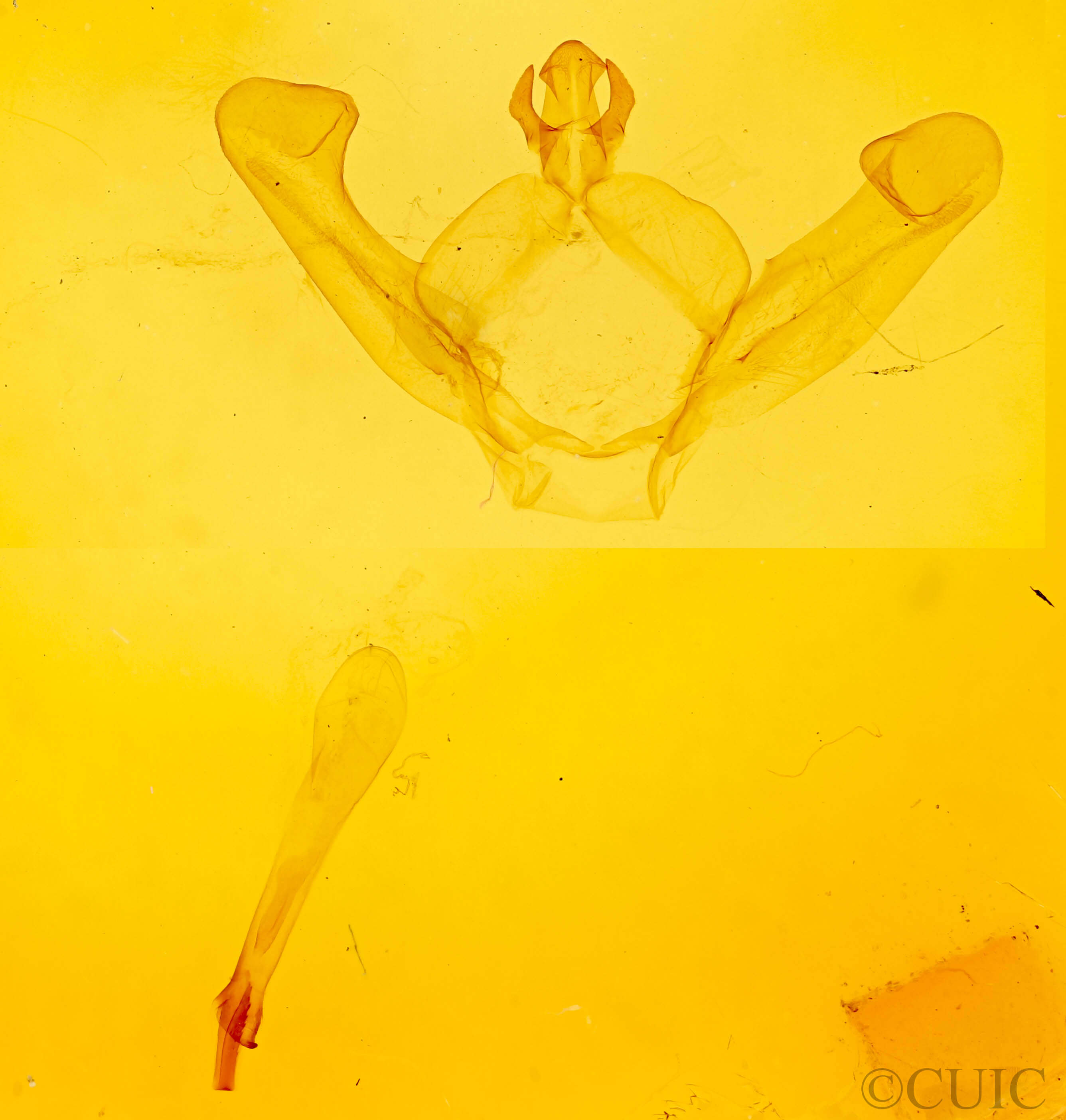 genitalia view of adult Hyparpax aurora