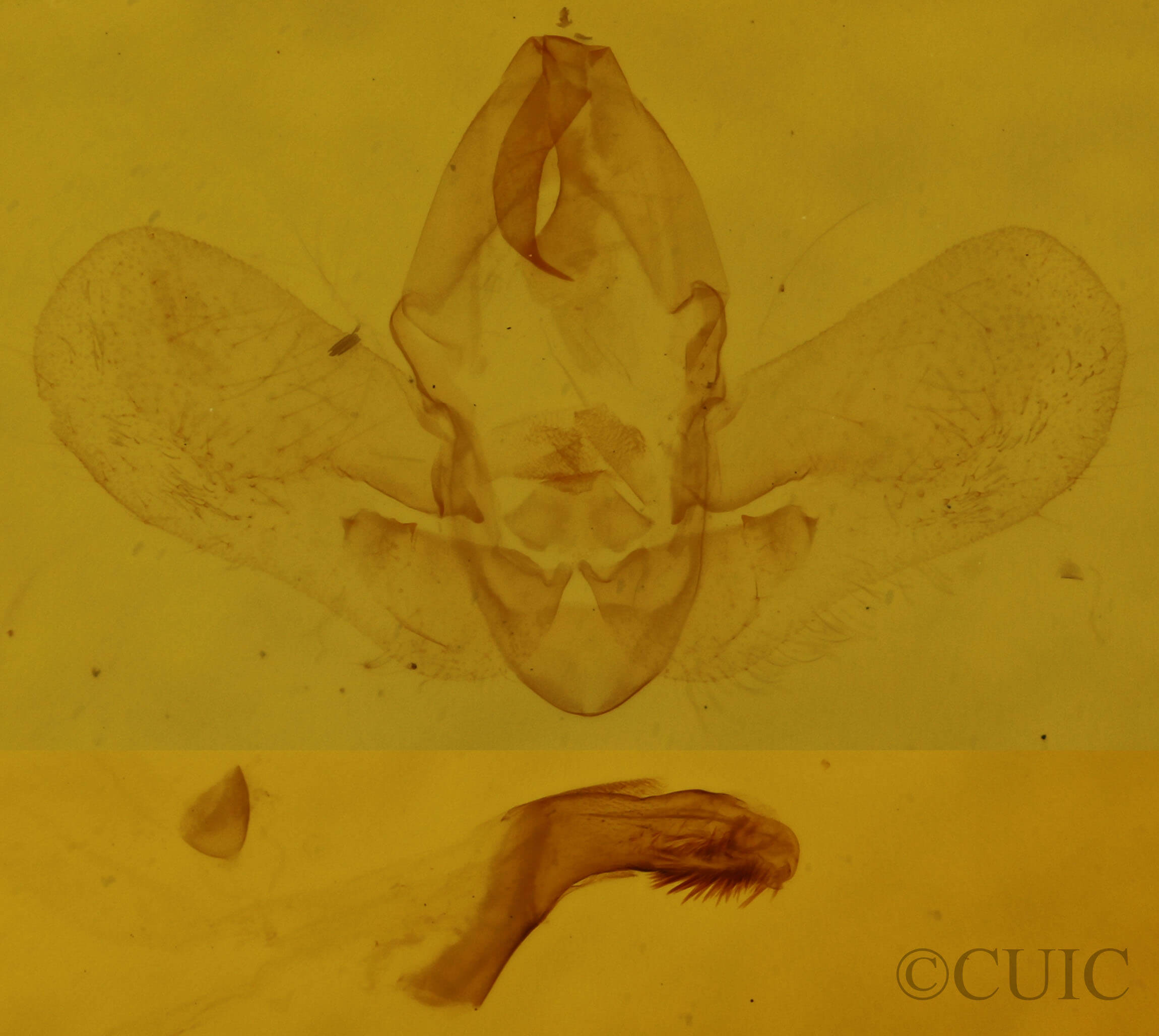 genitalia view of adult Hypena sp.