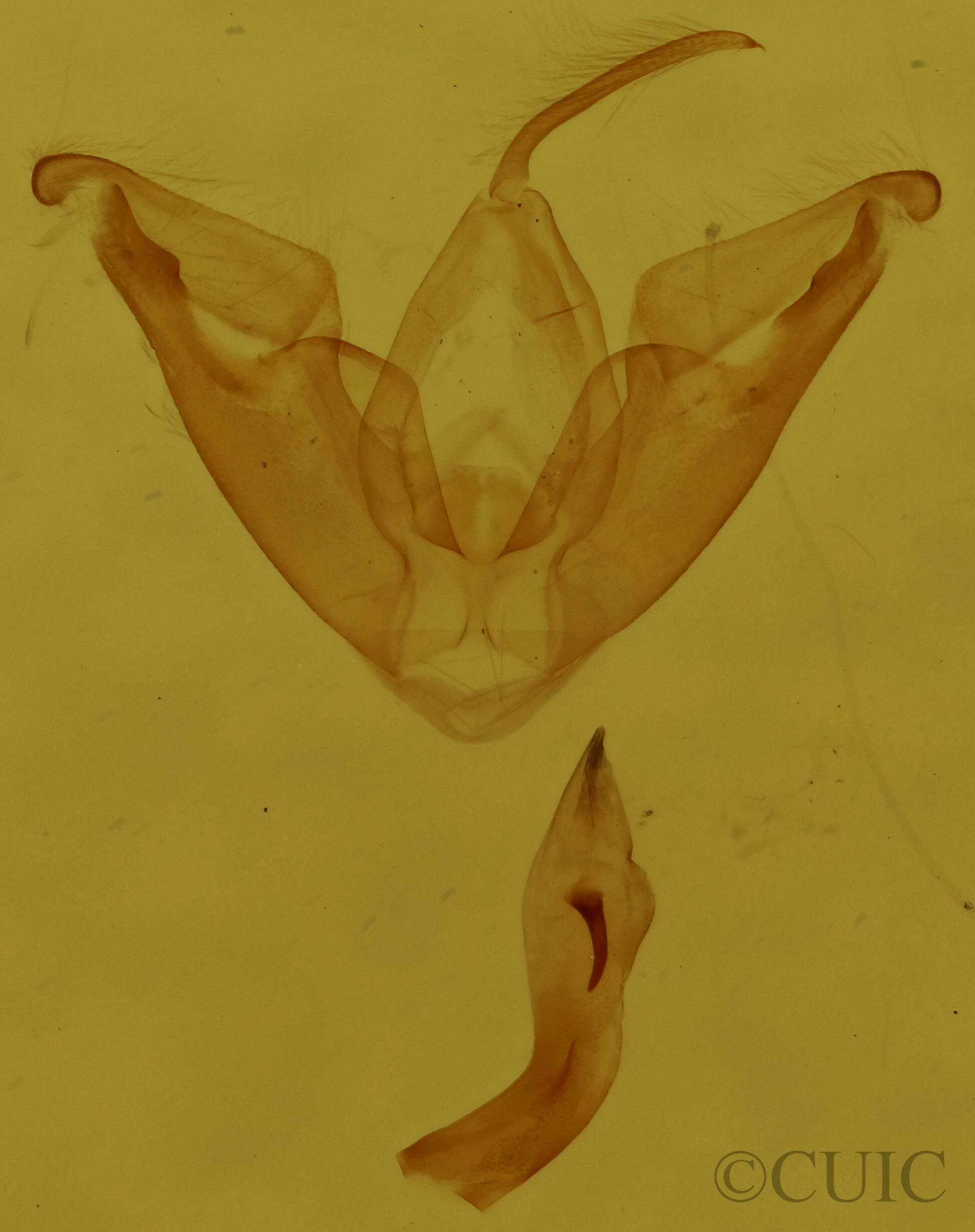 genitalia view of adult Hyperstrotia pervertens