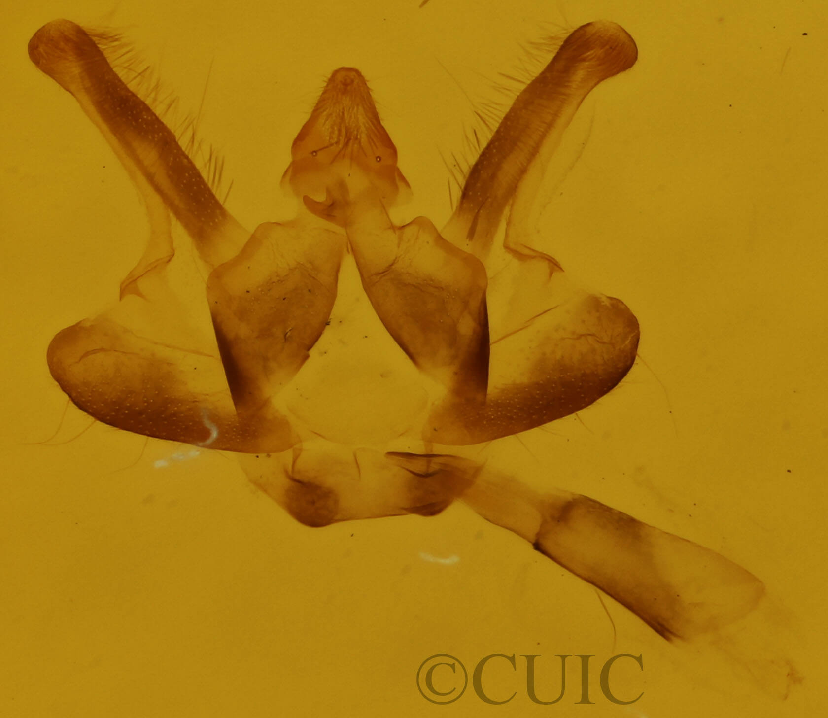 genitalia view of adult Epelis truncataria