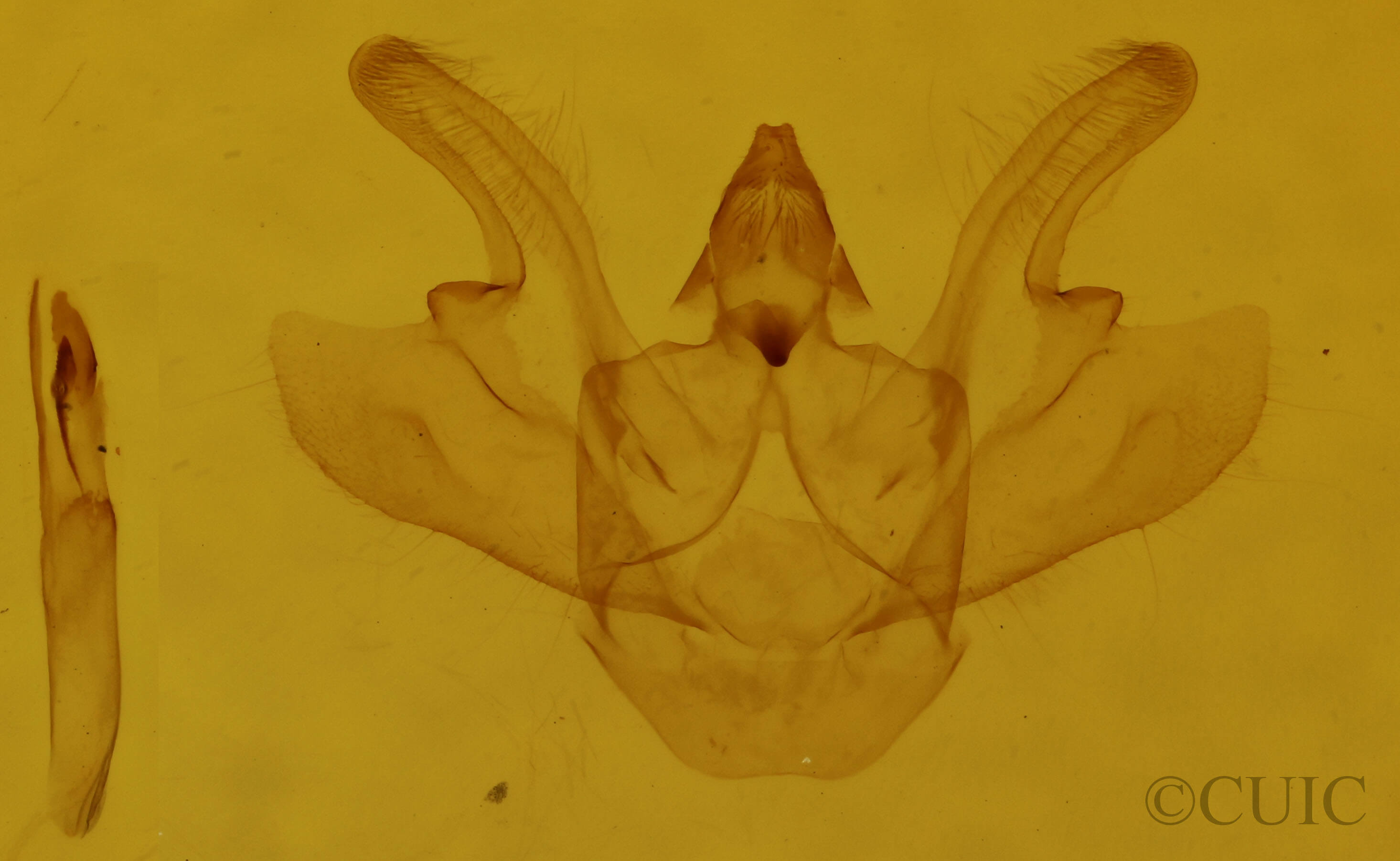 genitalia view of adult Macaria exauspicata