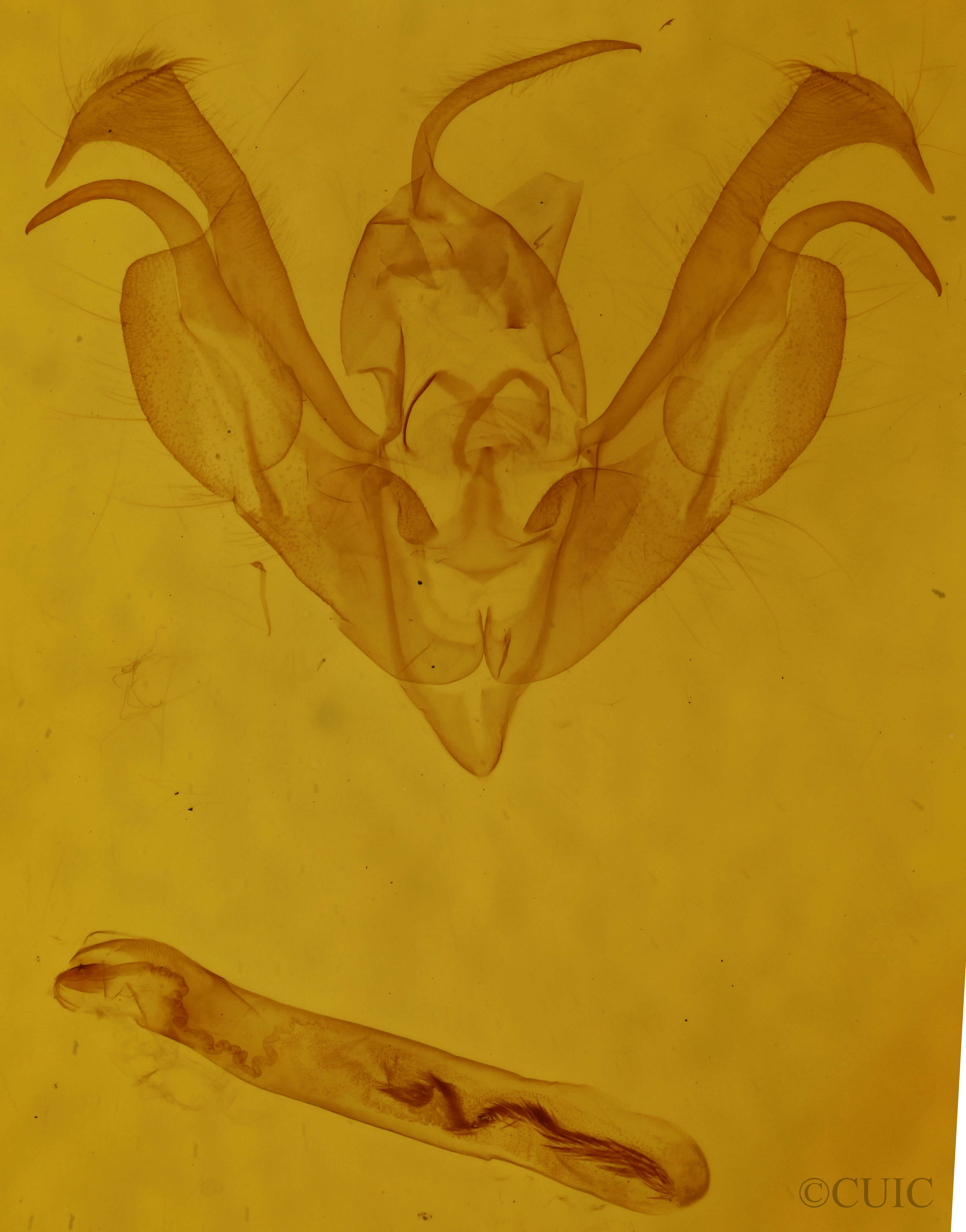 genitalia view of adult Lacinipolia renigera